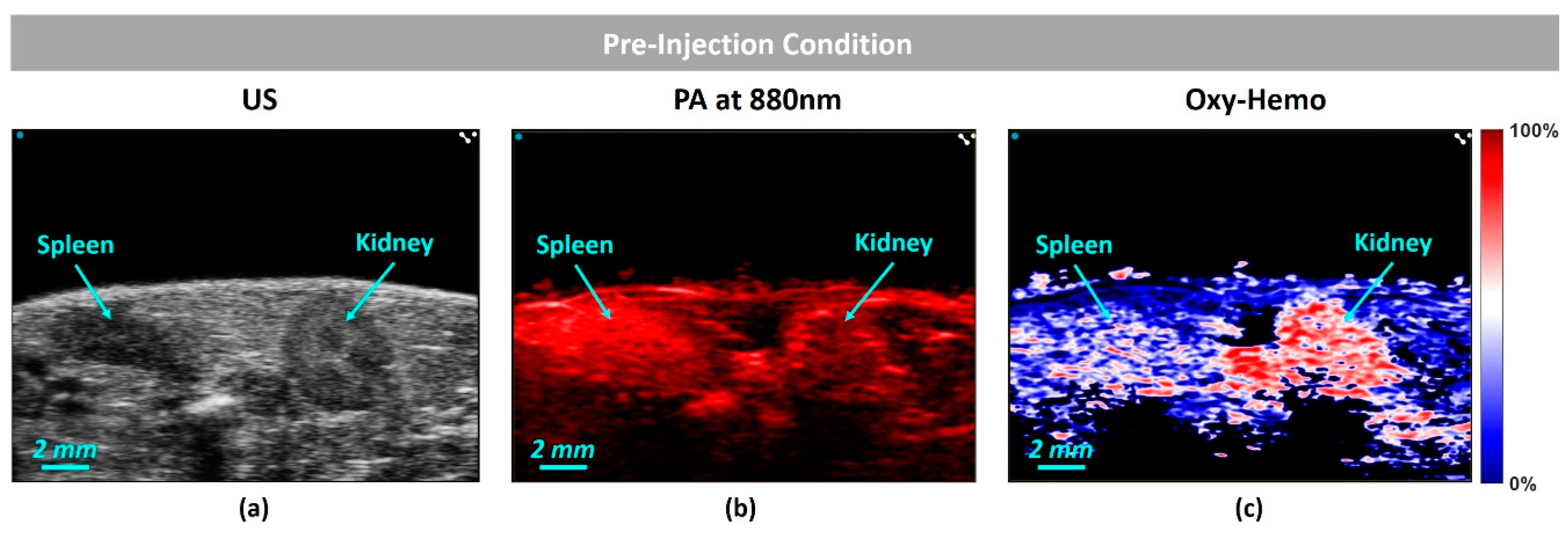 Sensors 20 03235 g006