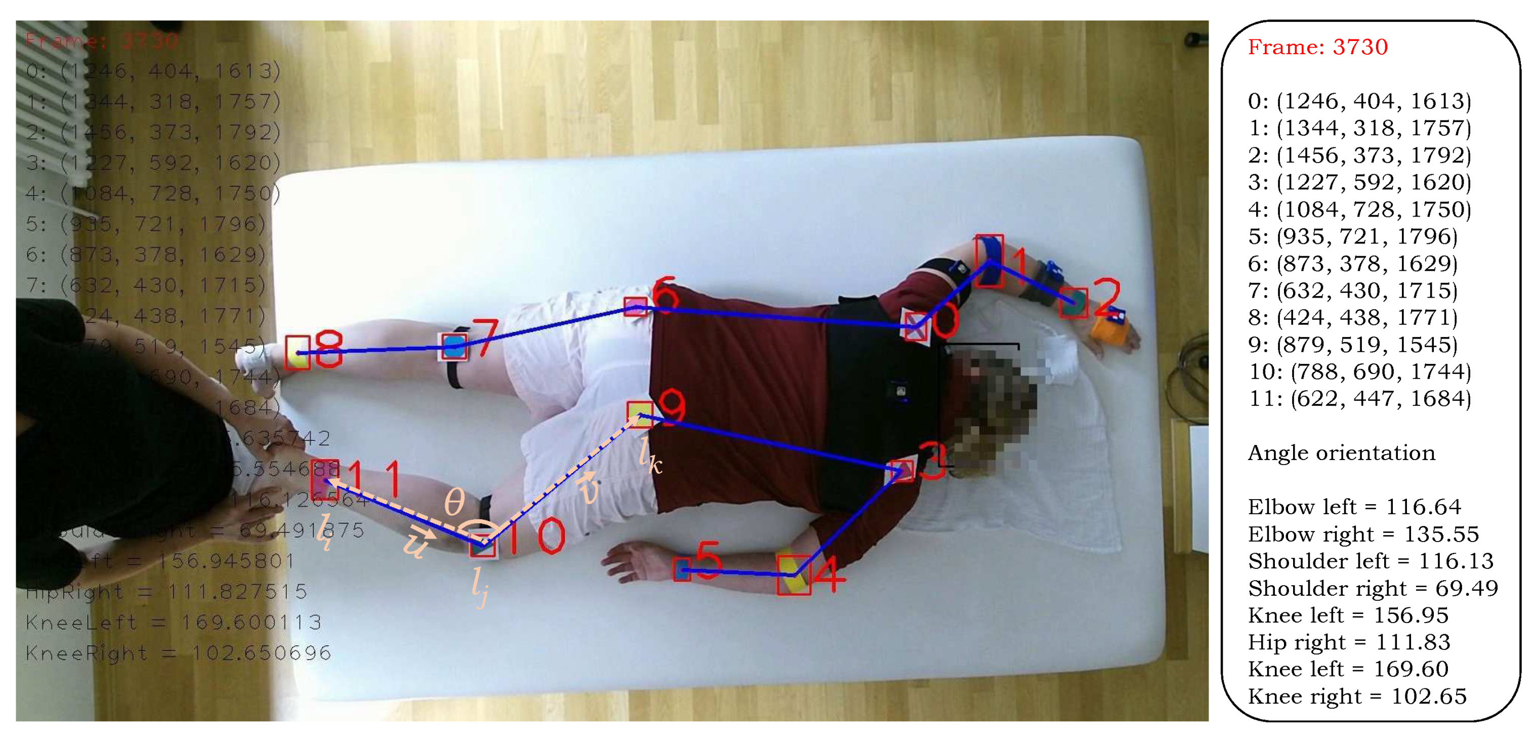 Sensors 20 03312 g004