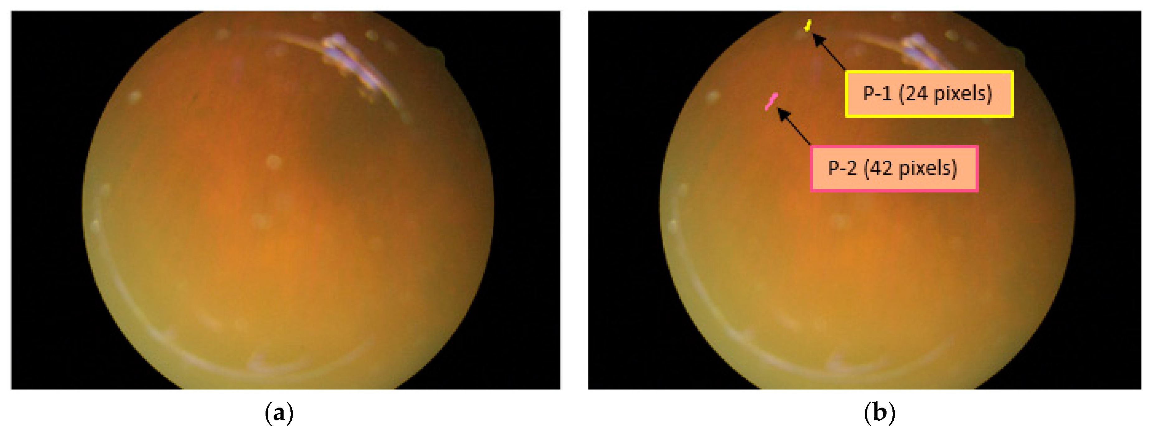 Sensors 20 03454 g007