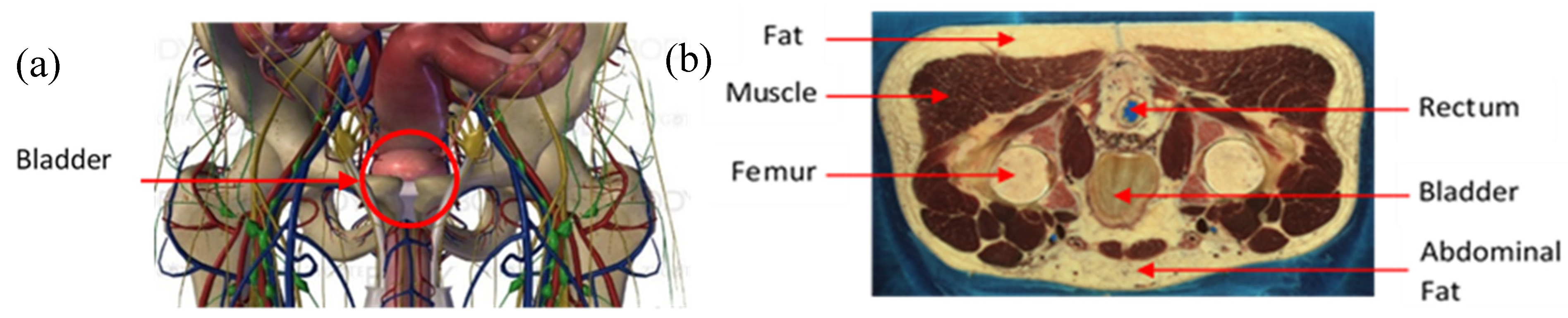 Sensors 20 03980 g002