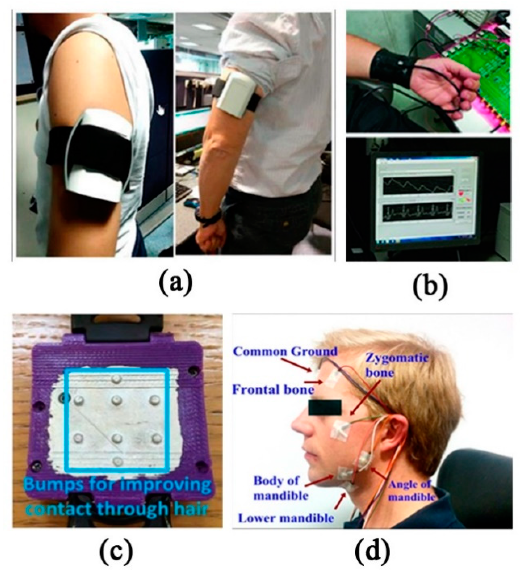 Sensors 20 04009 g003