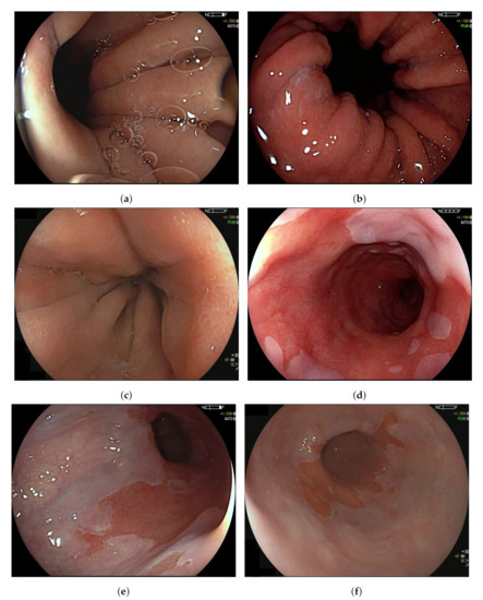 Sensors 20 04133 g0a1