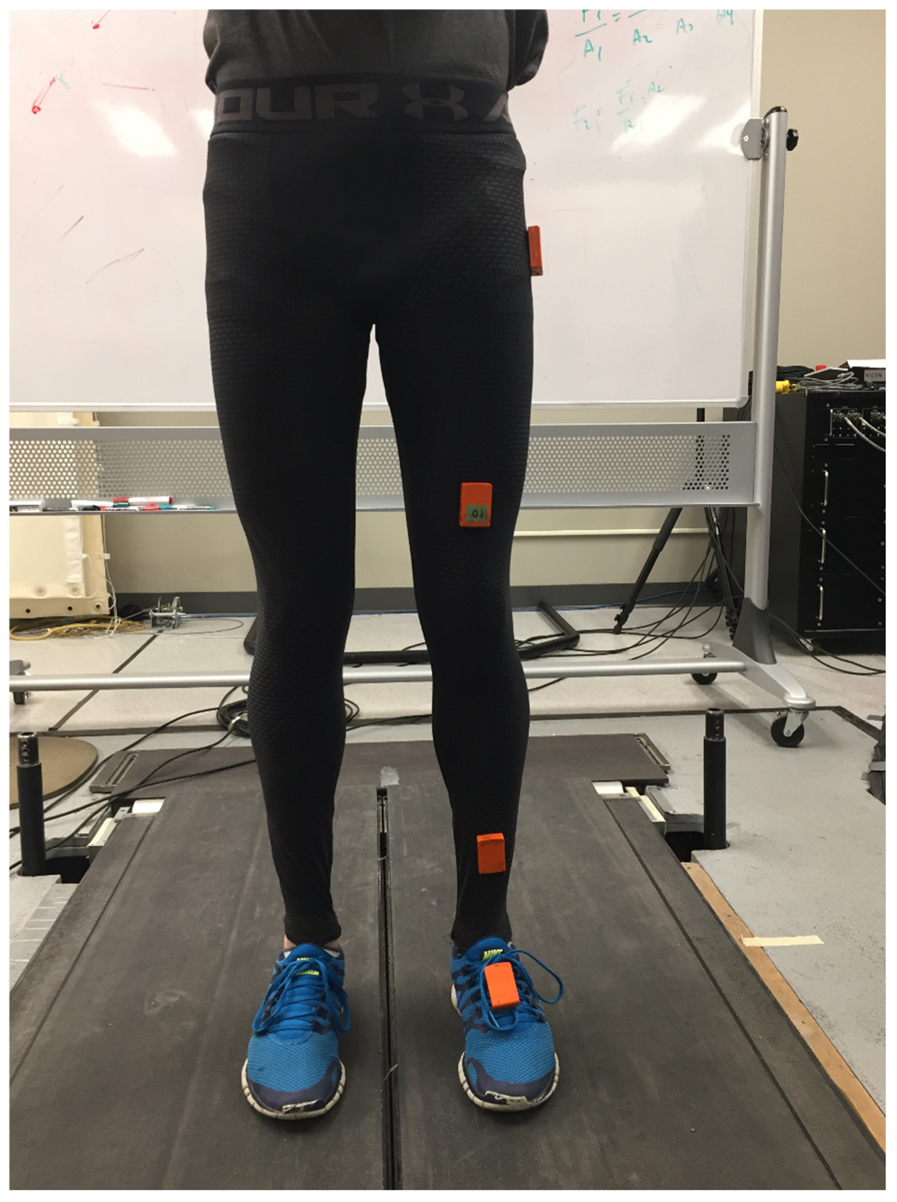 Sensors 20 04345 g001 Sensors 20 04345 g001