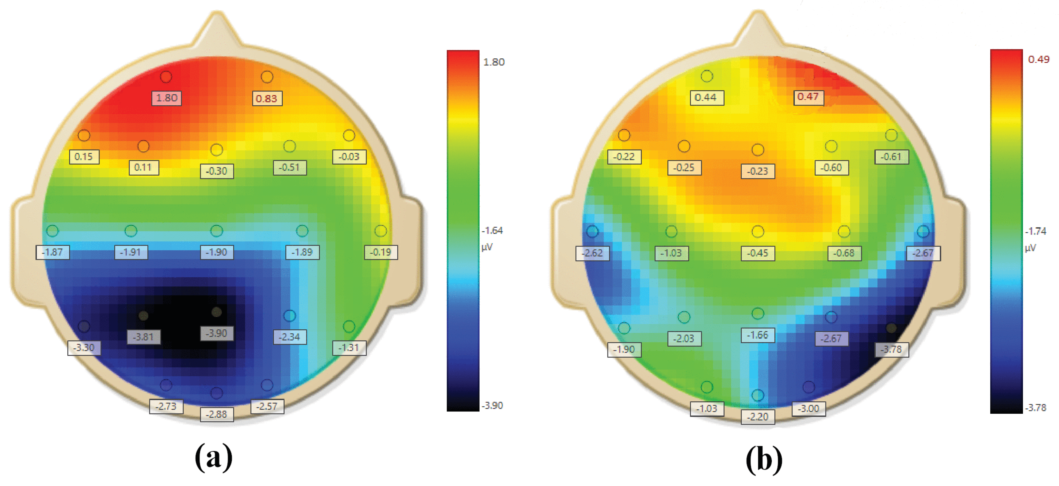 Sensors 20 04400 g005 Sensors 20 04400 g005