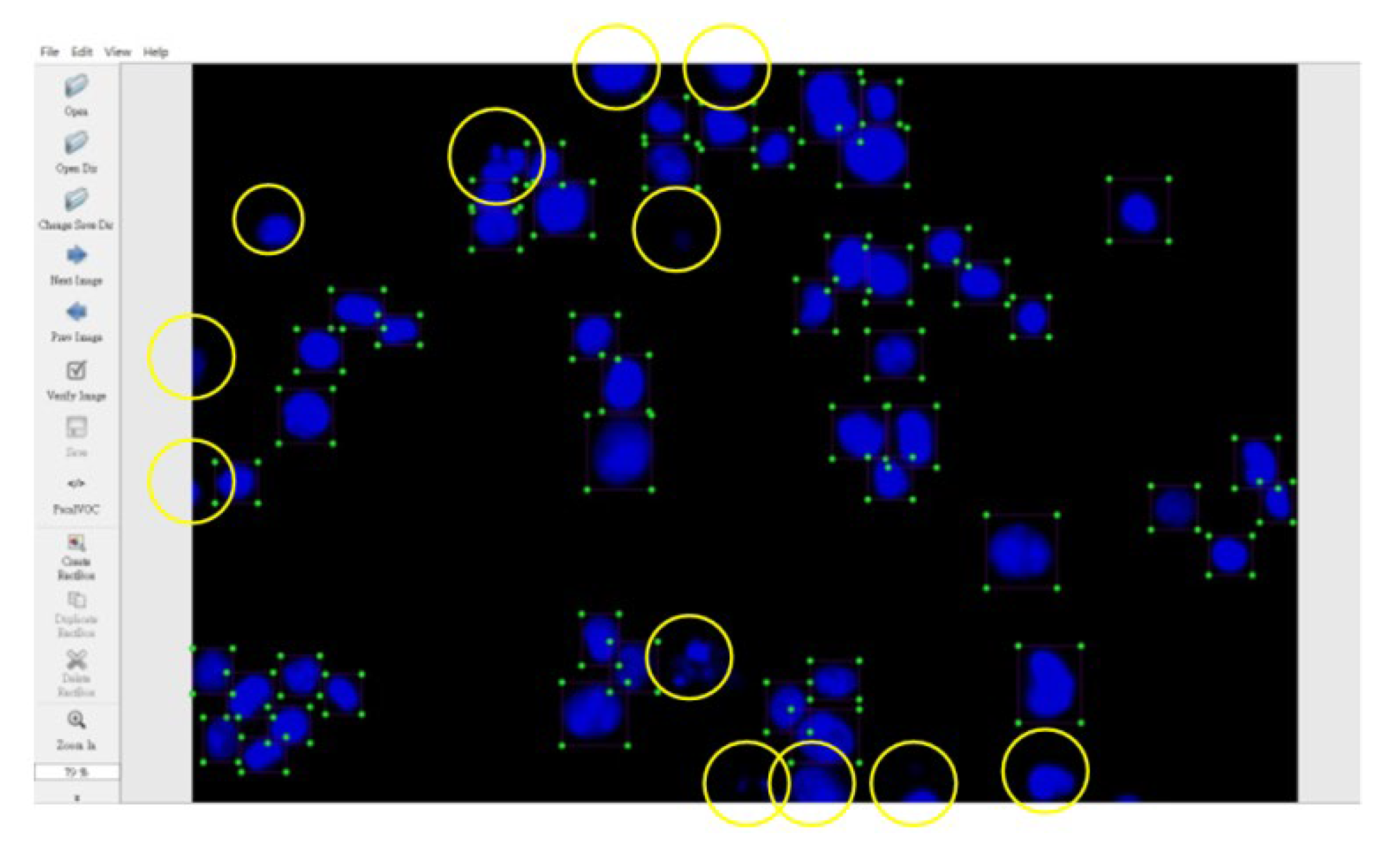Sensors 20 04409 g010