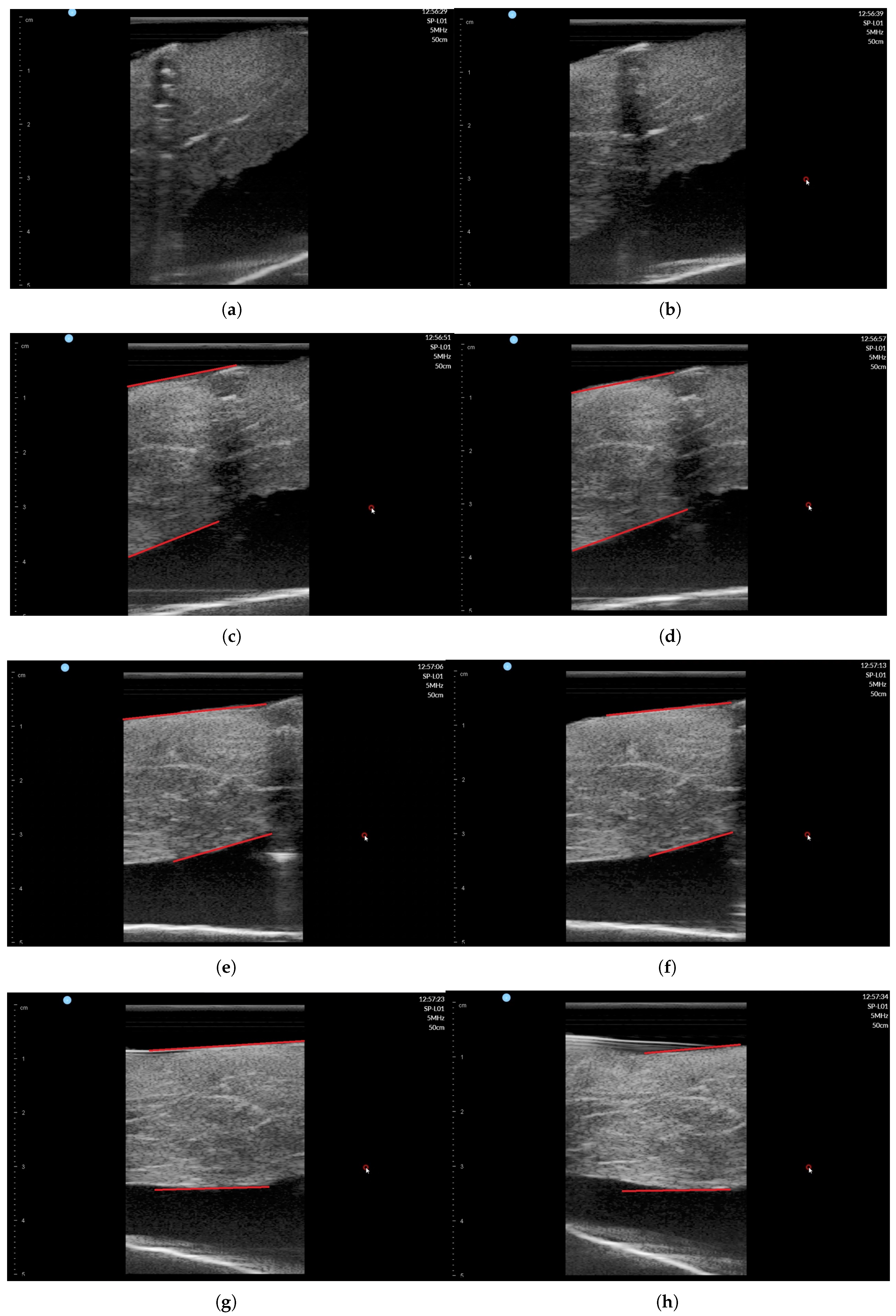 Sensors 20 04447 g018
