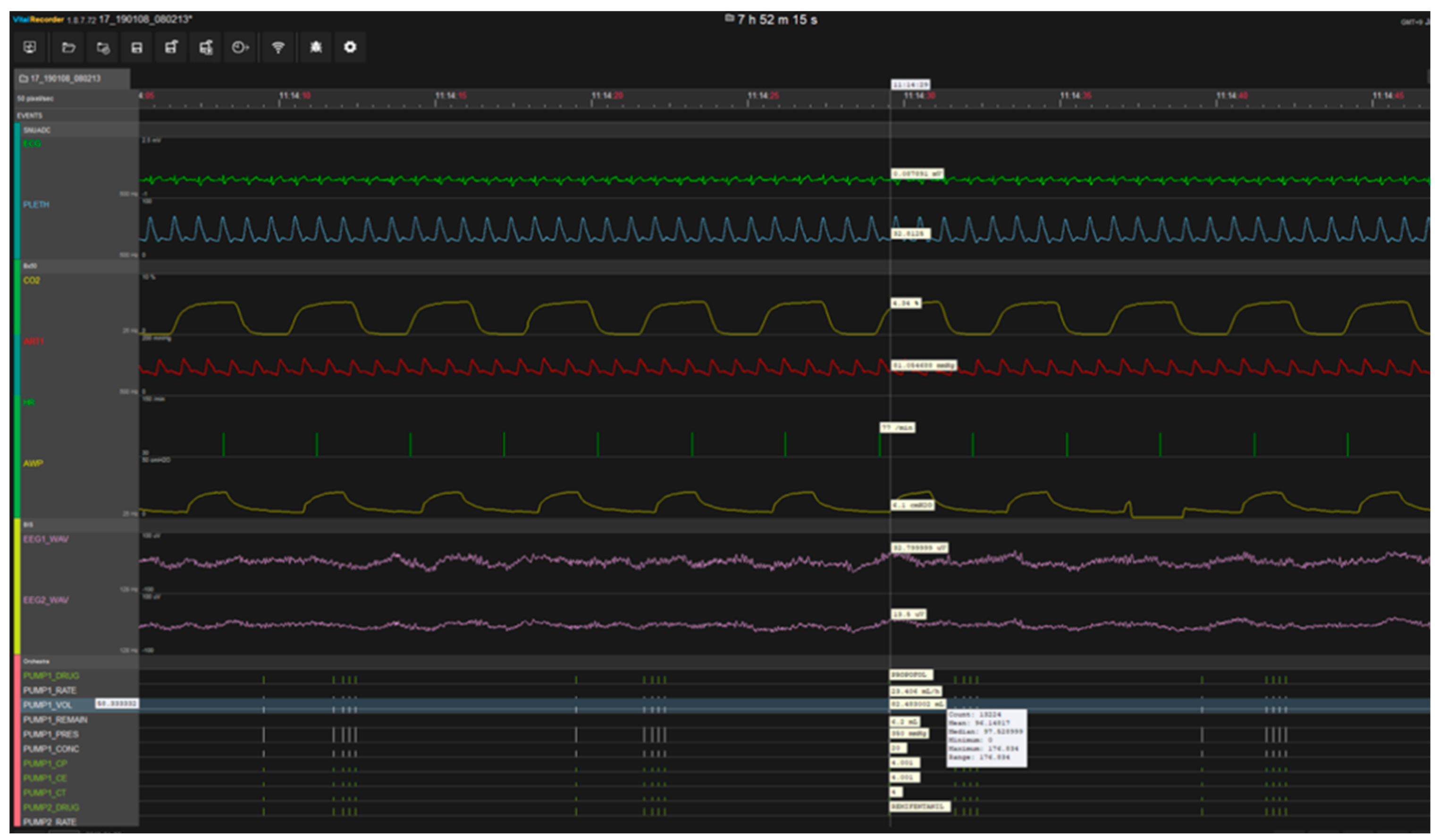 Sensors 20 04575 g001