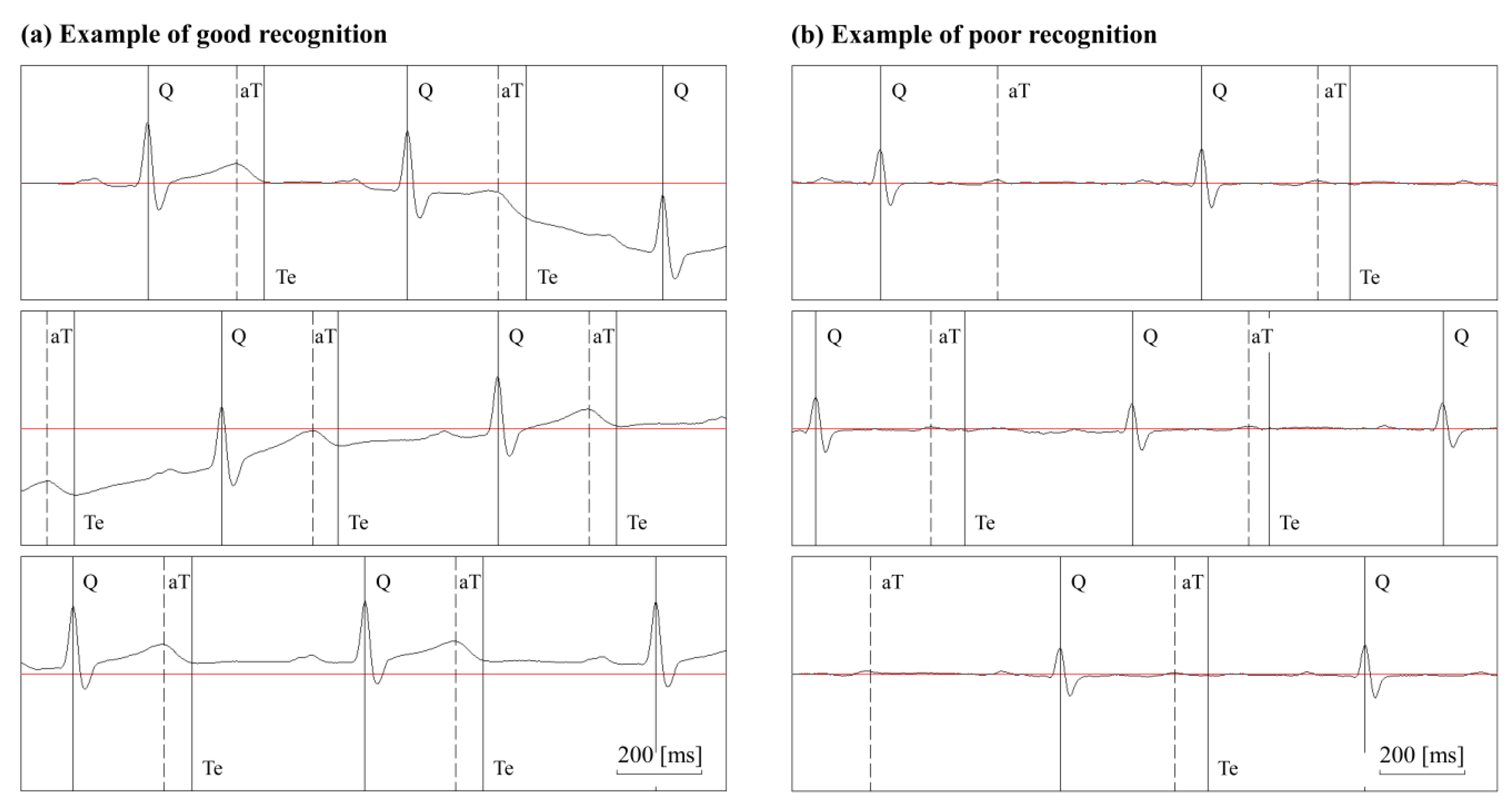 Sensors 20 04578 g004