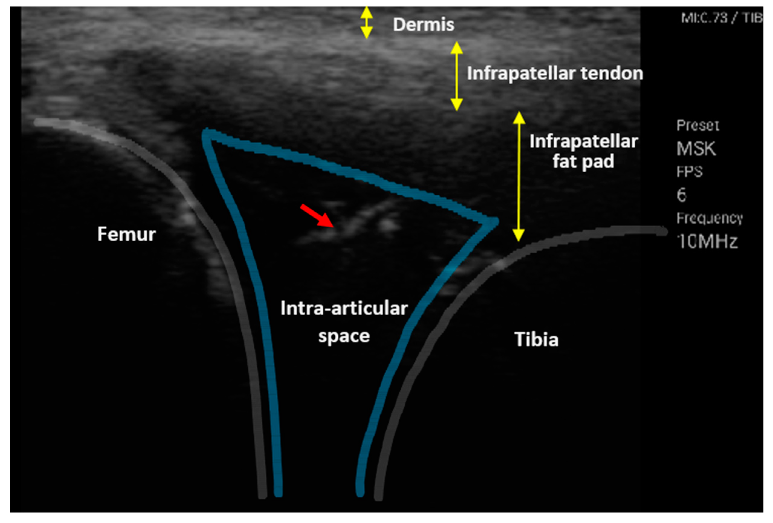 Sensors 20 04625 g007