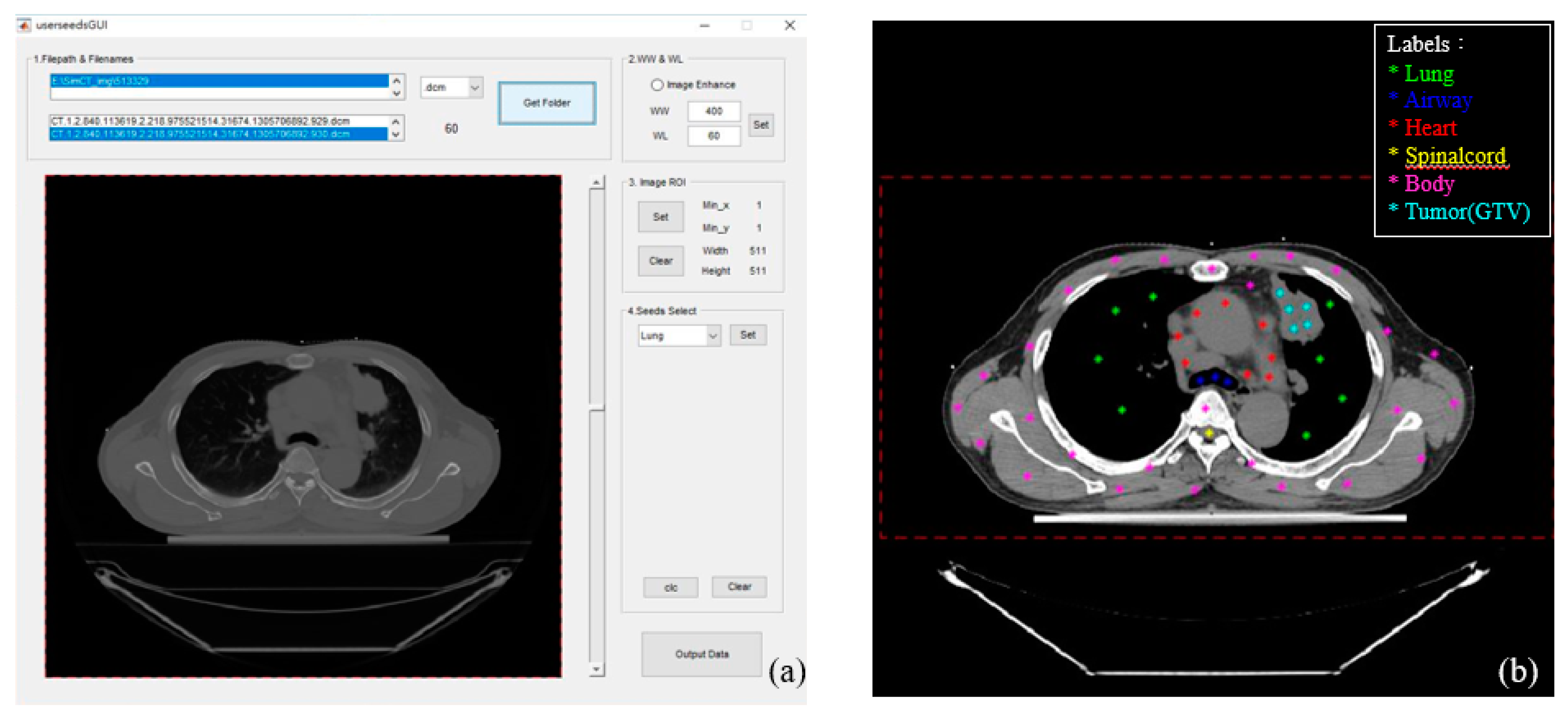 Sensors 20 04823 g001