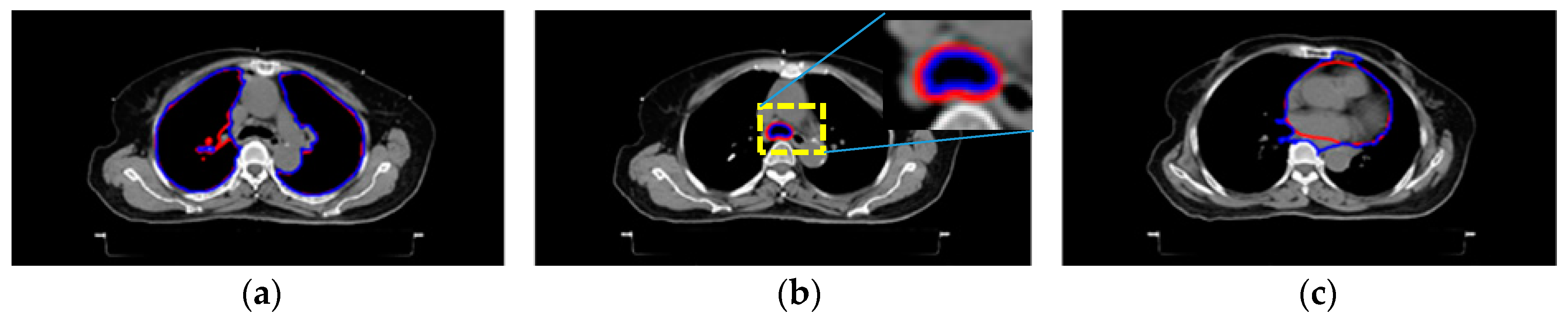 Sensors 20 04823 g003a