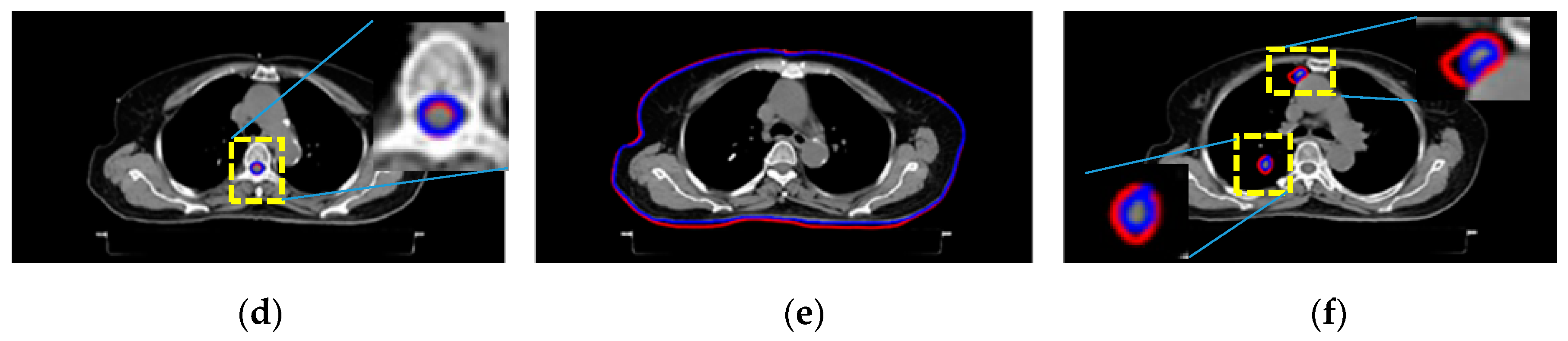 Sensors 20 04823 g003b