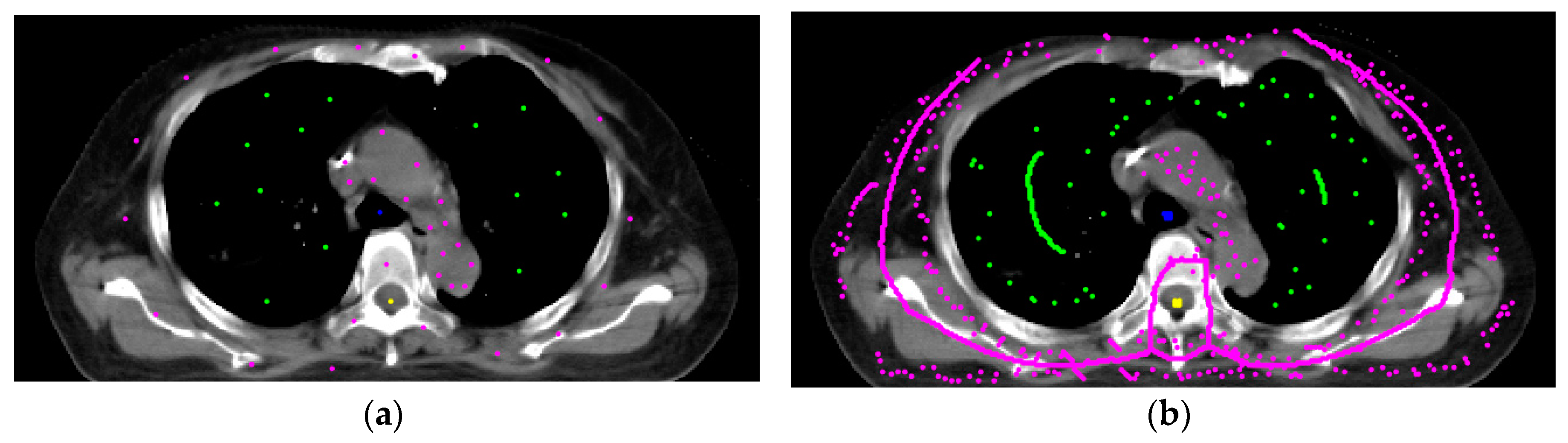 Sensors 20 04823 g004