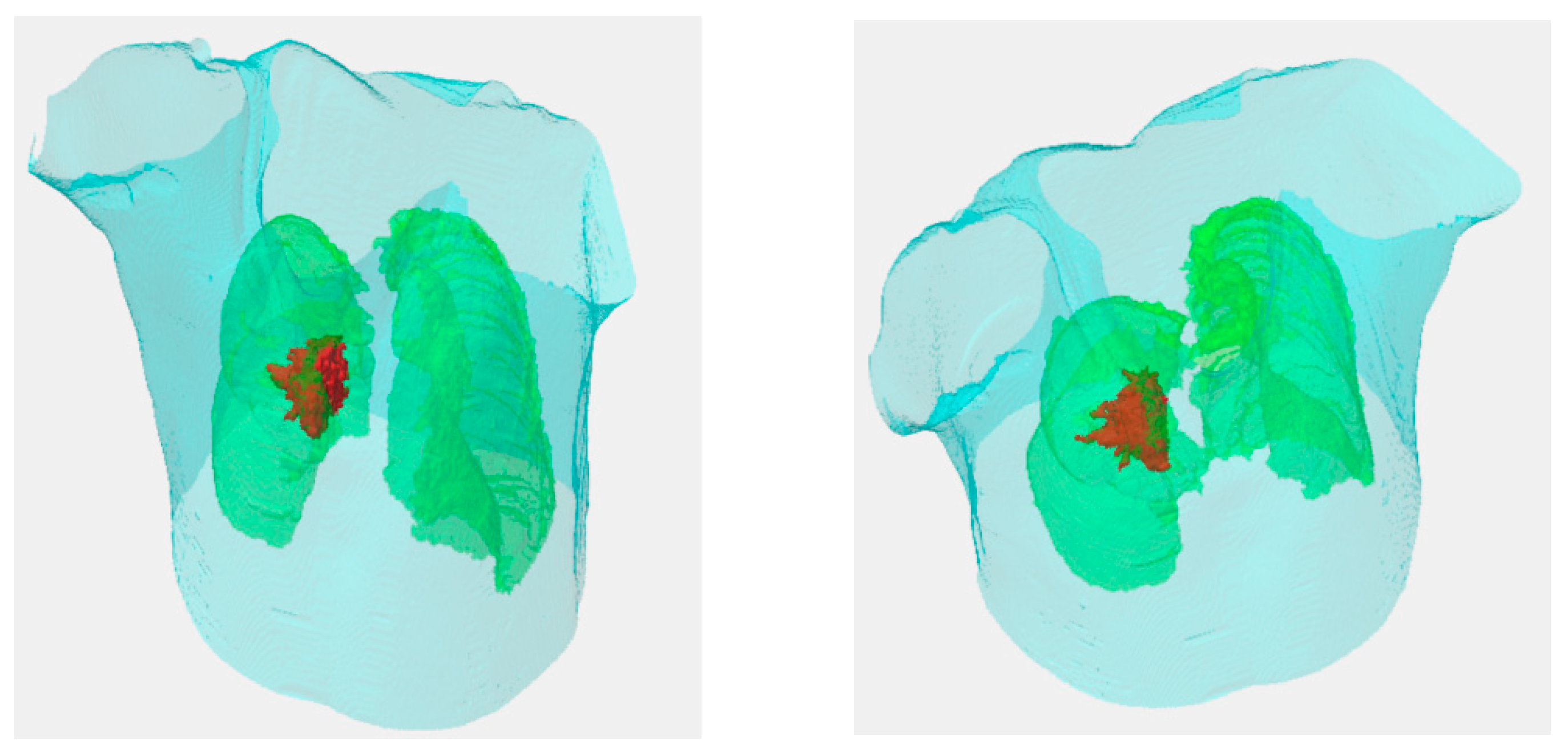 Sensors 20 04823 g005