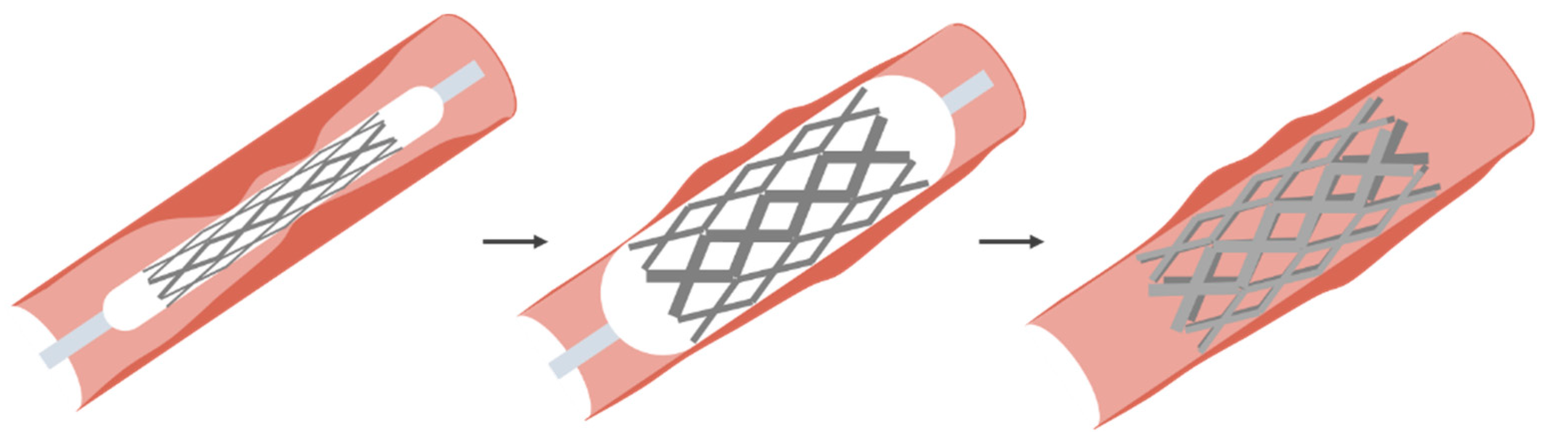 Sensors 20 04953 g006