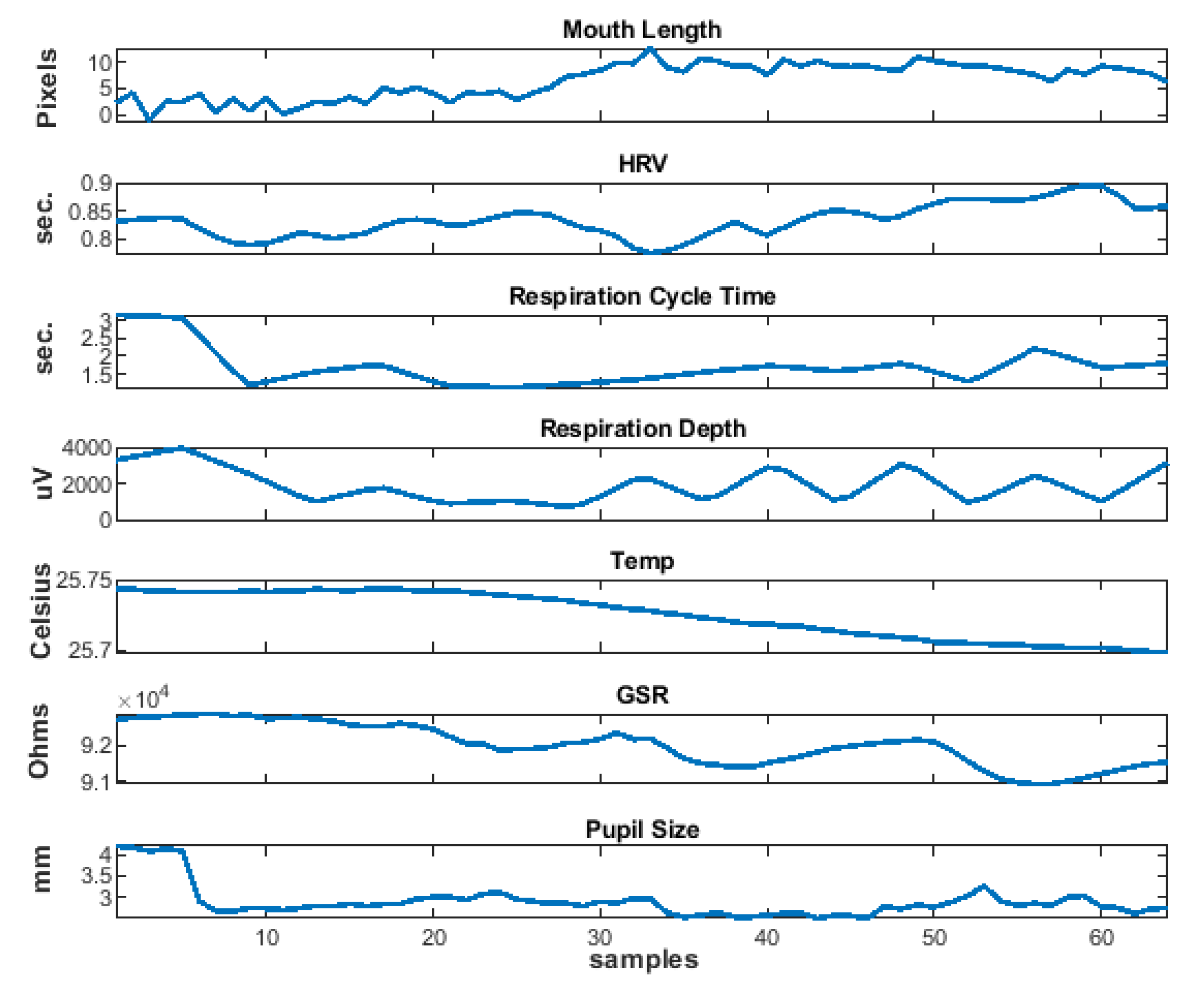 Sensors 20 05328 g004 Sensors 20 05328 g004