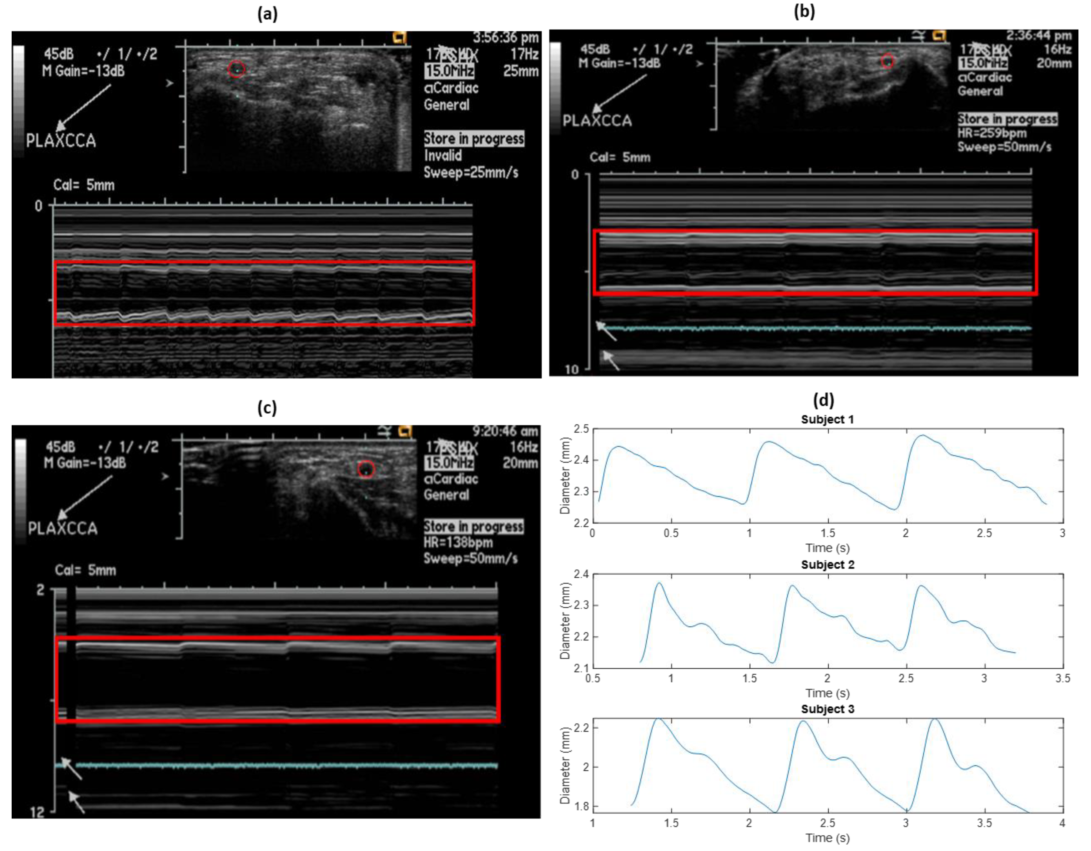 Sensors 20 05333 g005