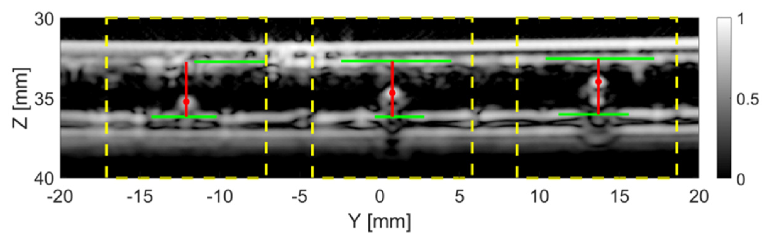 Sensors 20 05370 g011