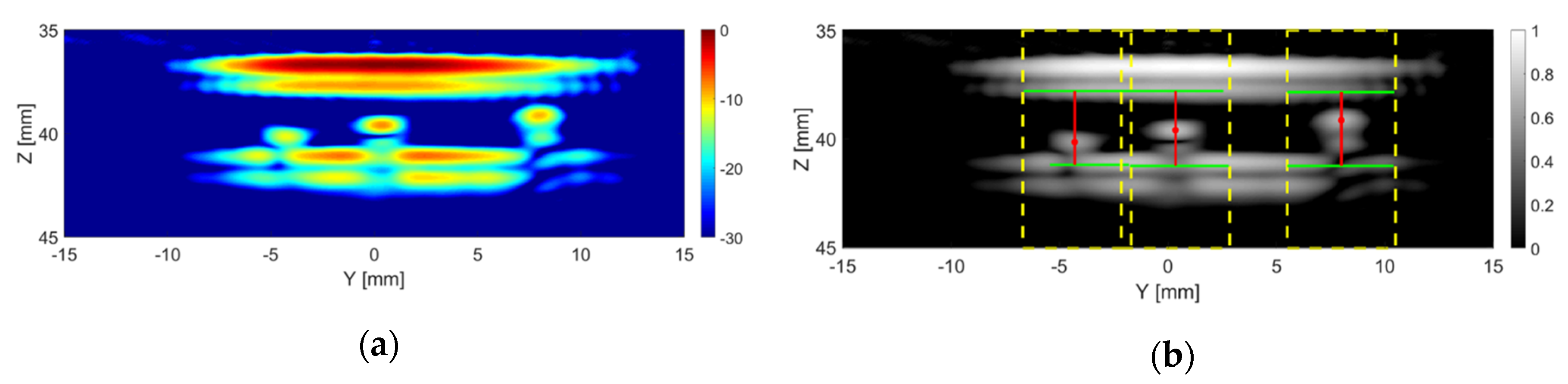 Sensors 20 05370 g012