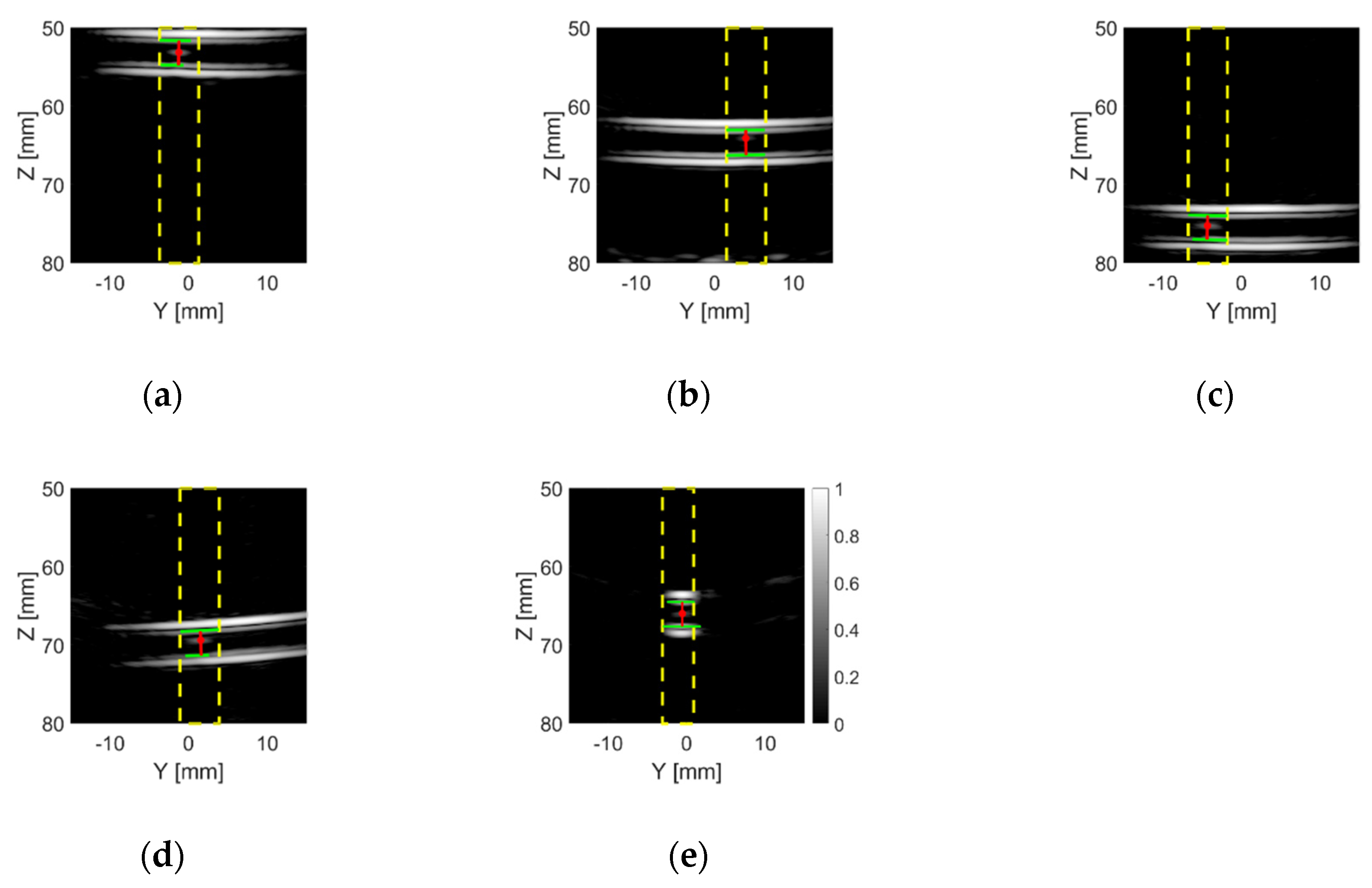 Sensors 20 05370 g017