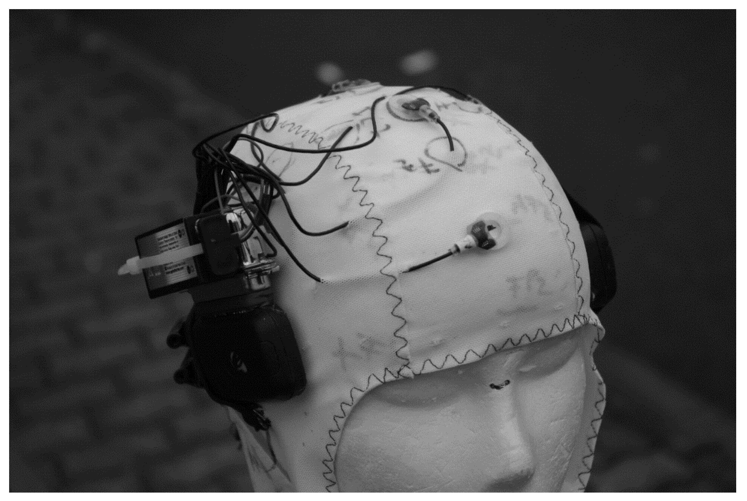 Sensors 20 05618 g008