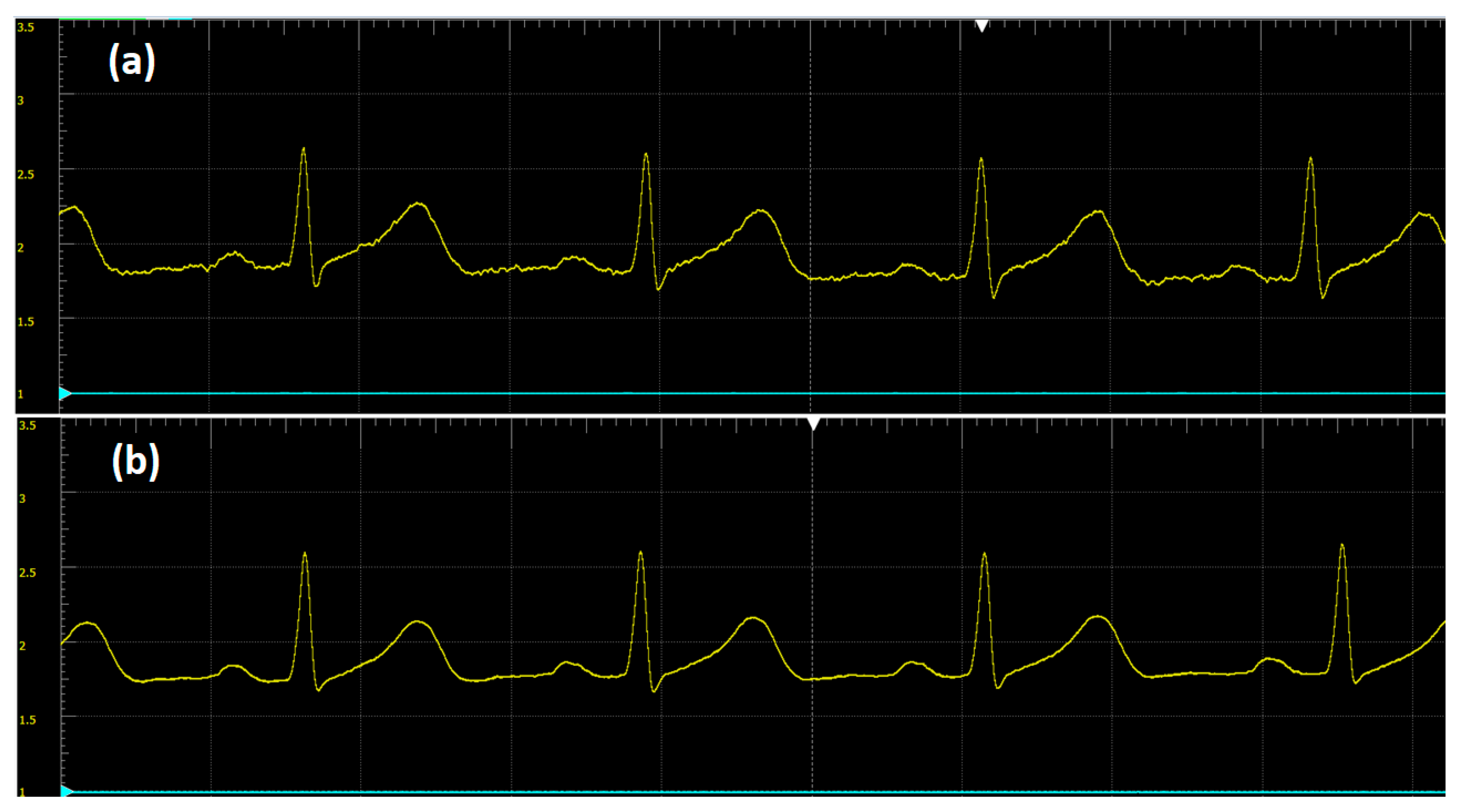 Sensors 20 05962 g013