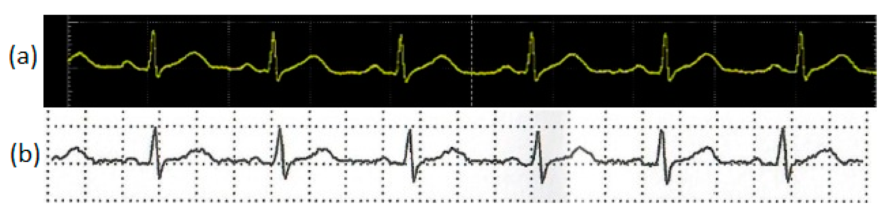 Sensors 20 05962 g016