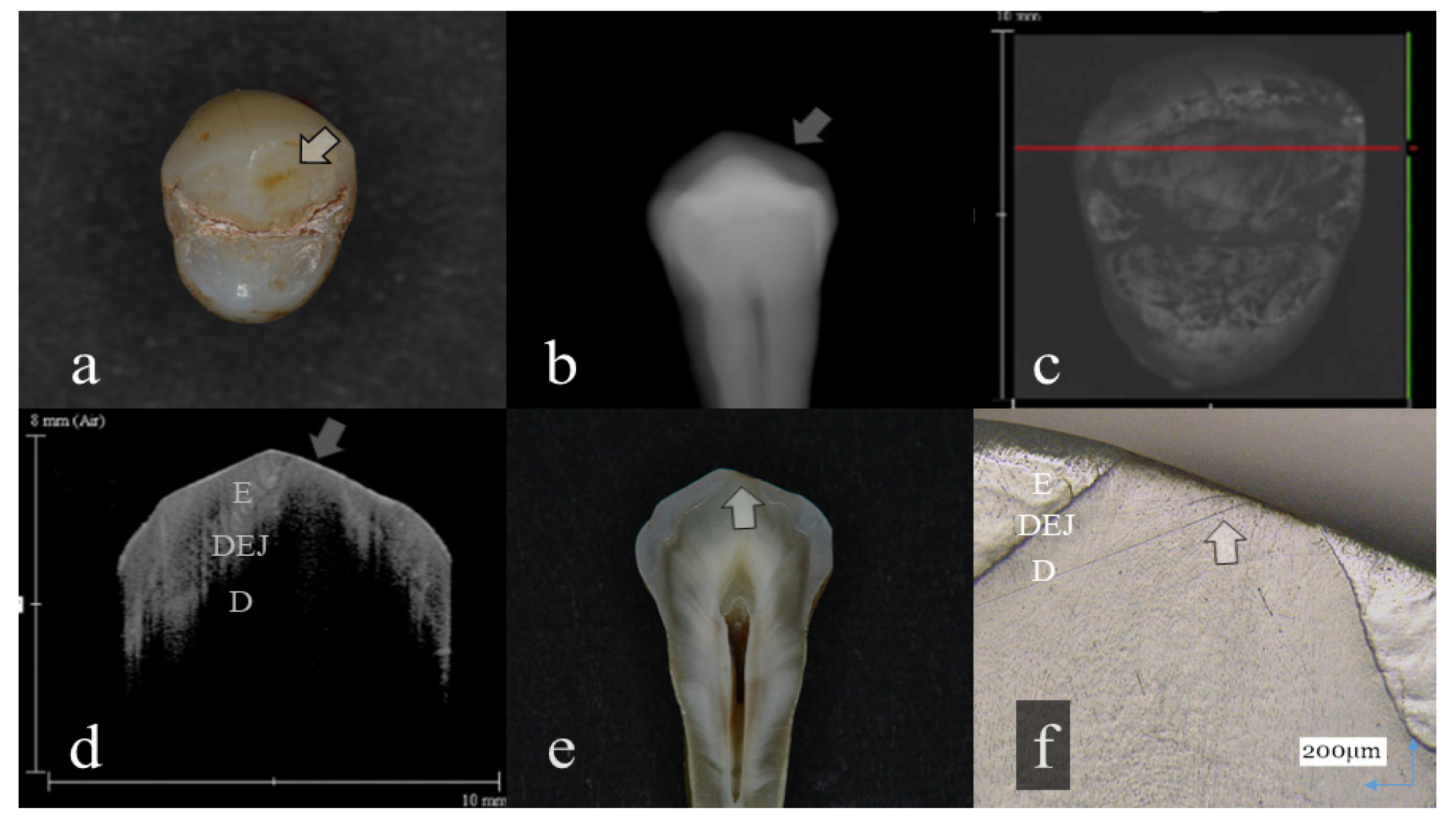 Sensors 20 06016 g005