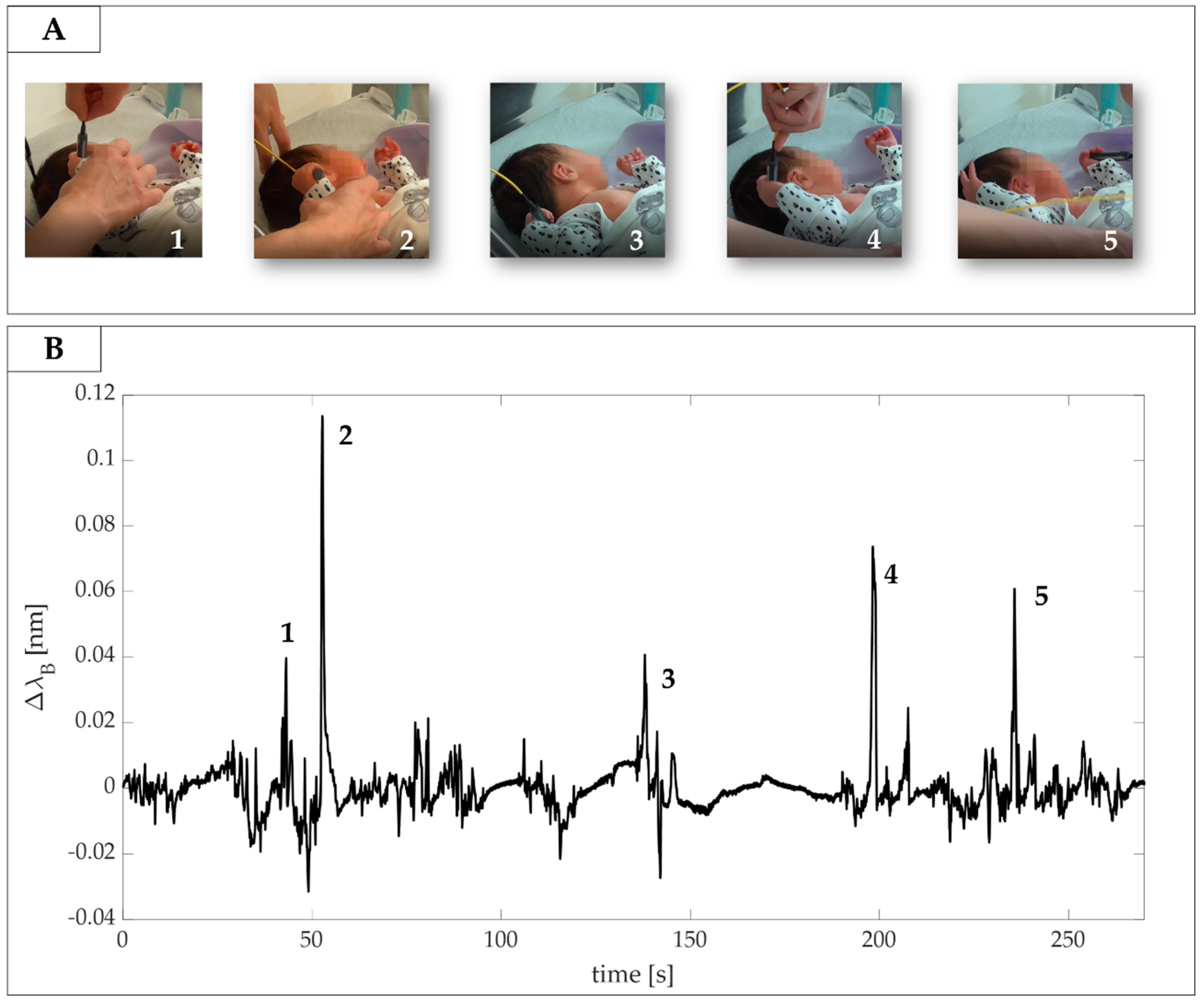 Sensors 20 06040 g008