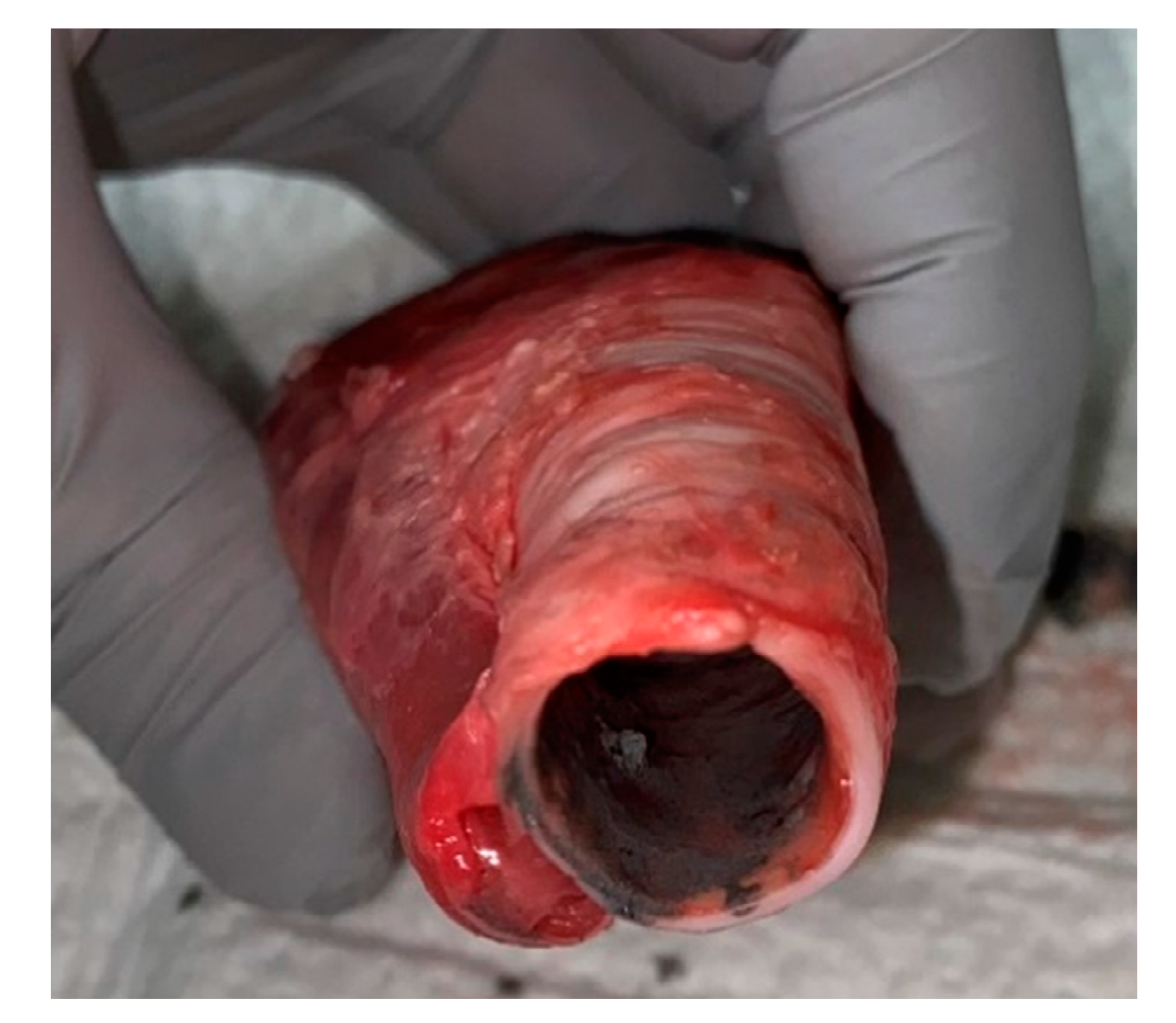 Sensors 20 06138 g002