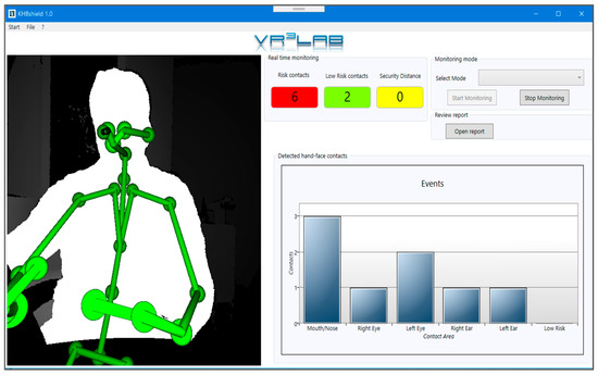 Sensors 20 06149 g0a1