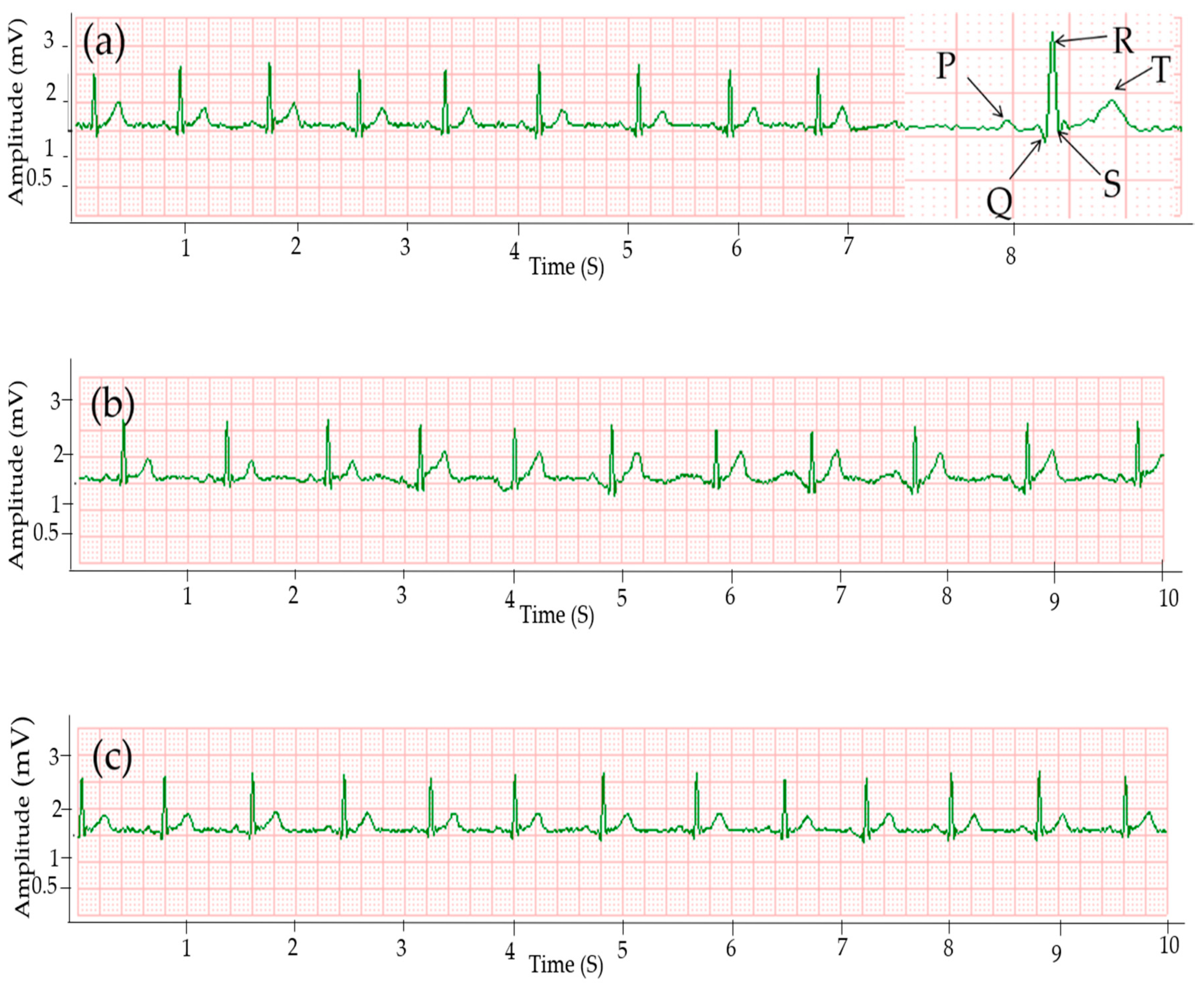 Sensors 20 06233 g003 Sensors 20 06233 g003