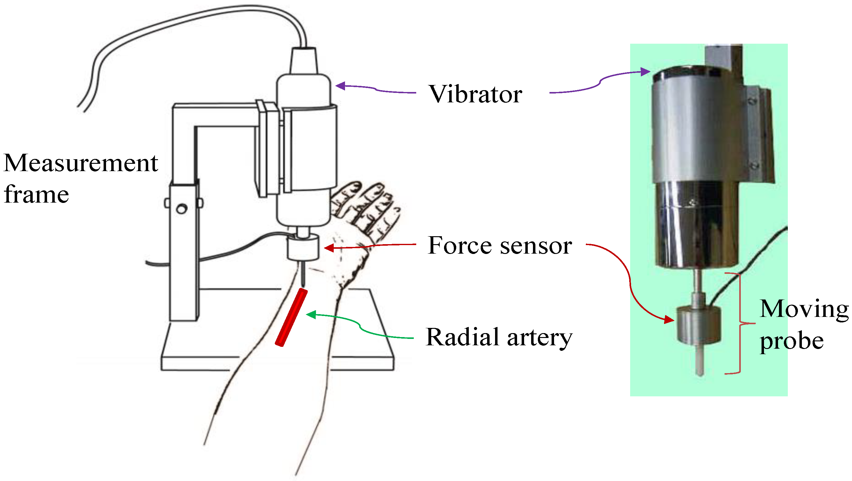 Sensors 20 06463 g004 Sensors 20 06463 g004