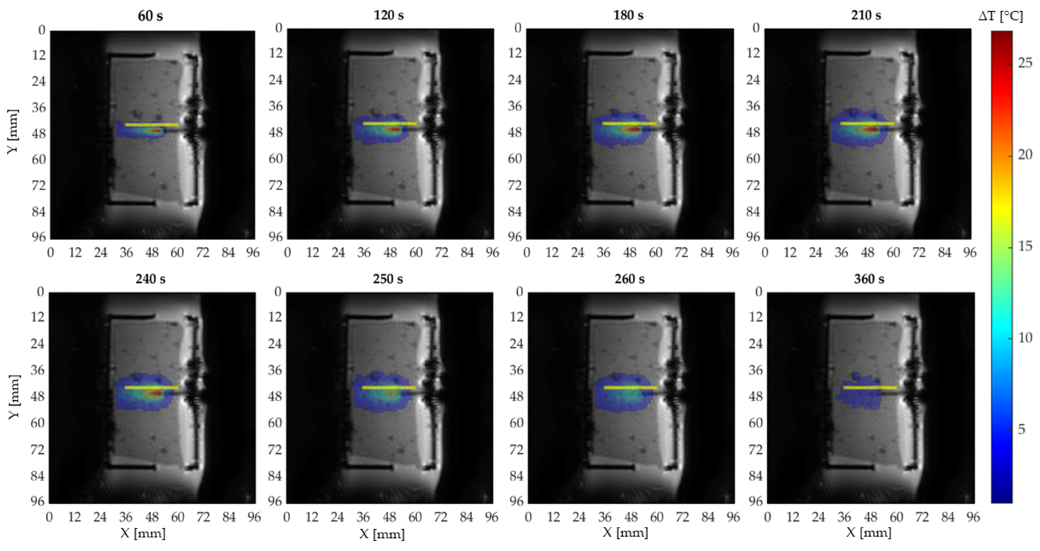 Sensors 20 06468 g005