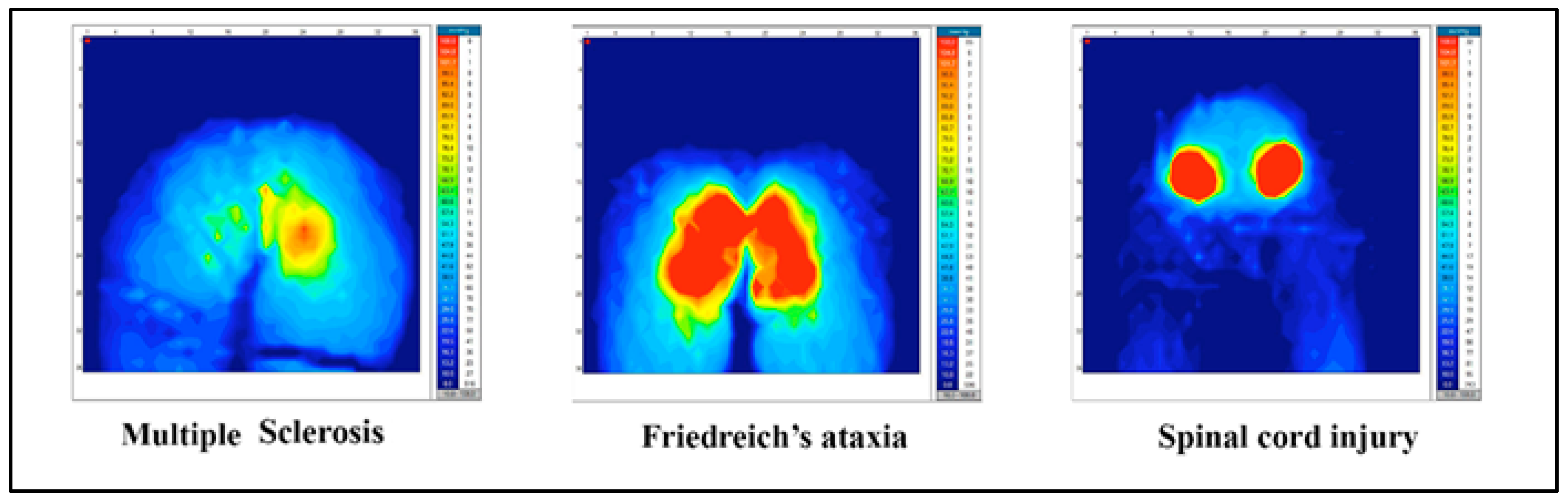 Sensors 20 06488 g003