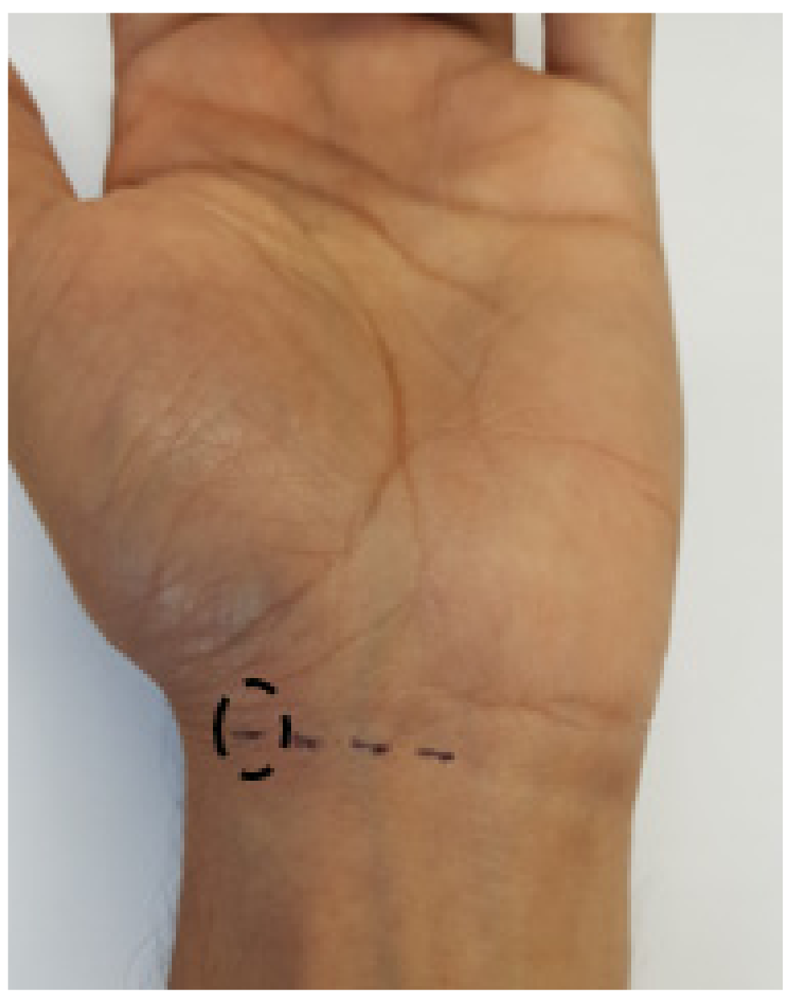 Sensors 20 06568 g005