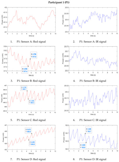 Sensors 20 06568 g0a1a Sensors 20 06568 g0a1a
