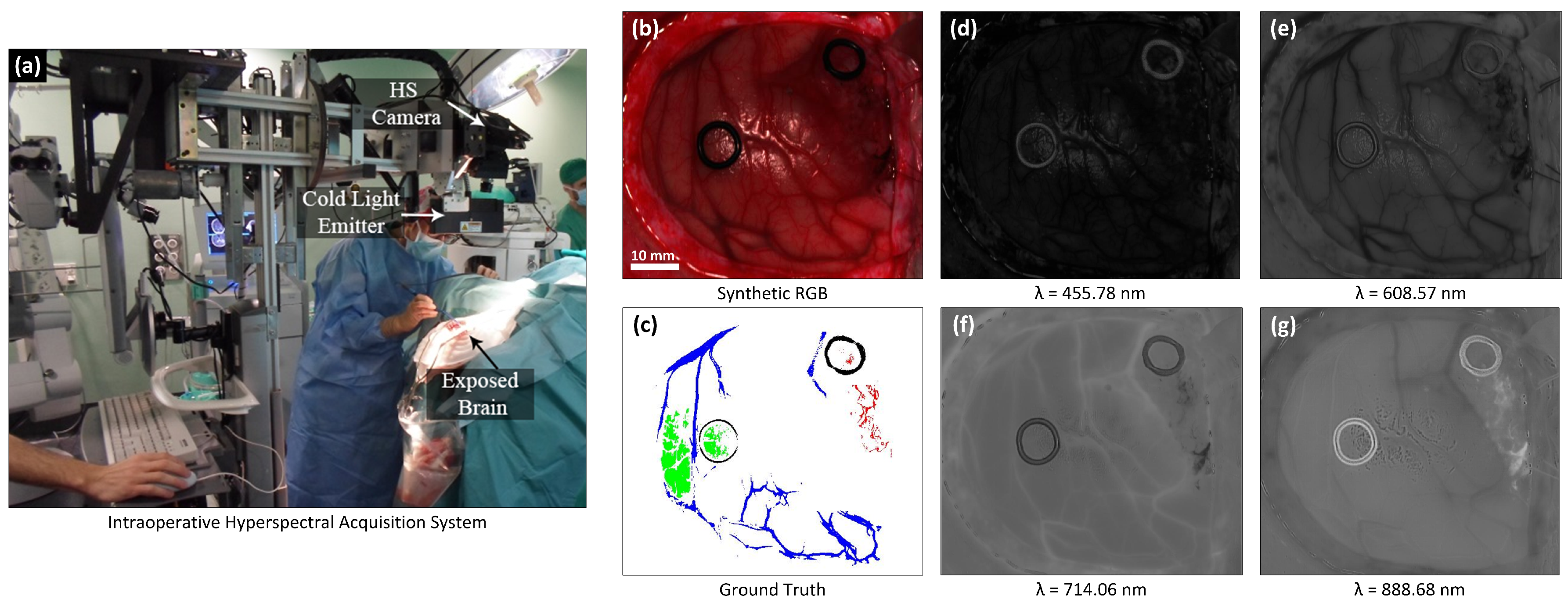 Sensors 20 06955 g001