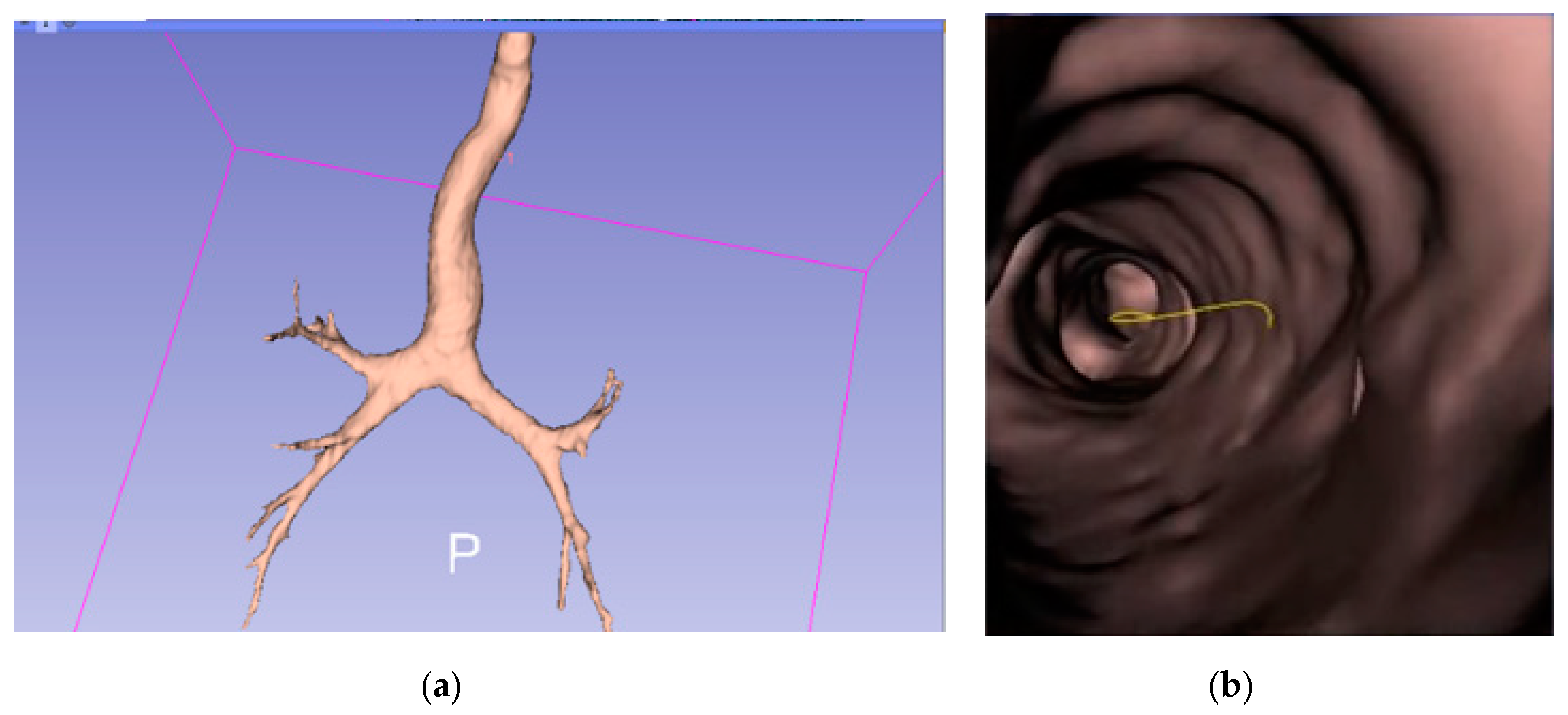 Sensors 20 06997 g002