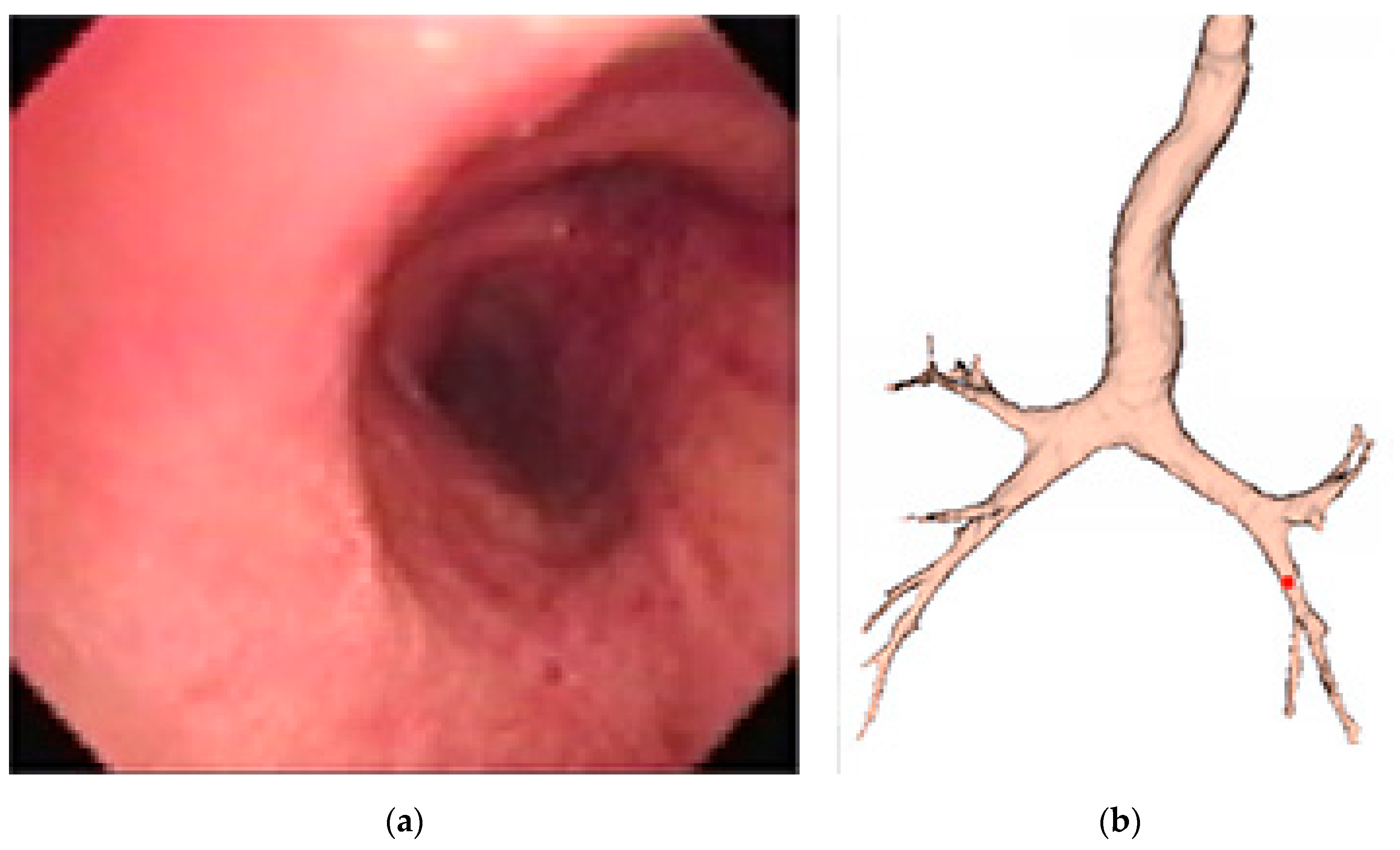 Sensors 20 06997 g003