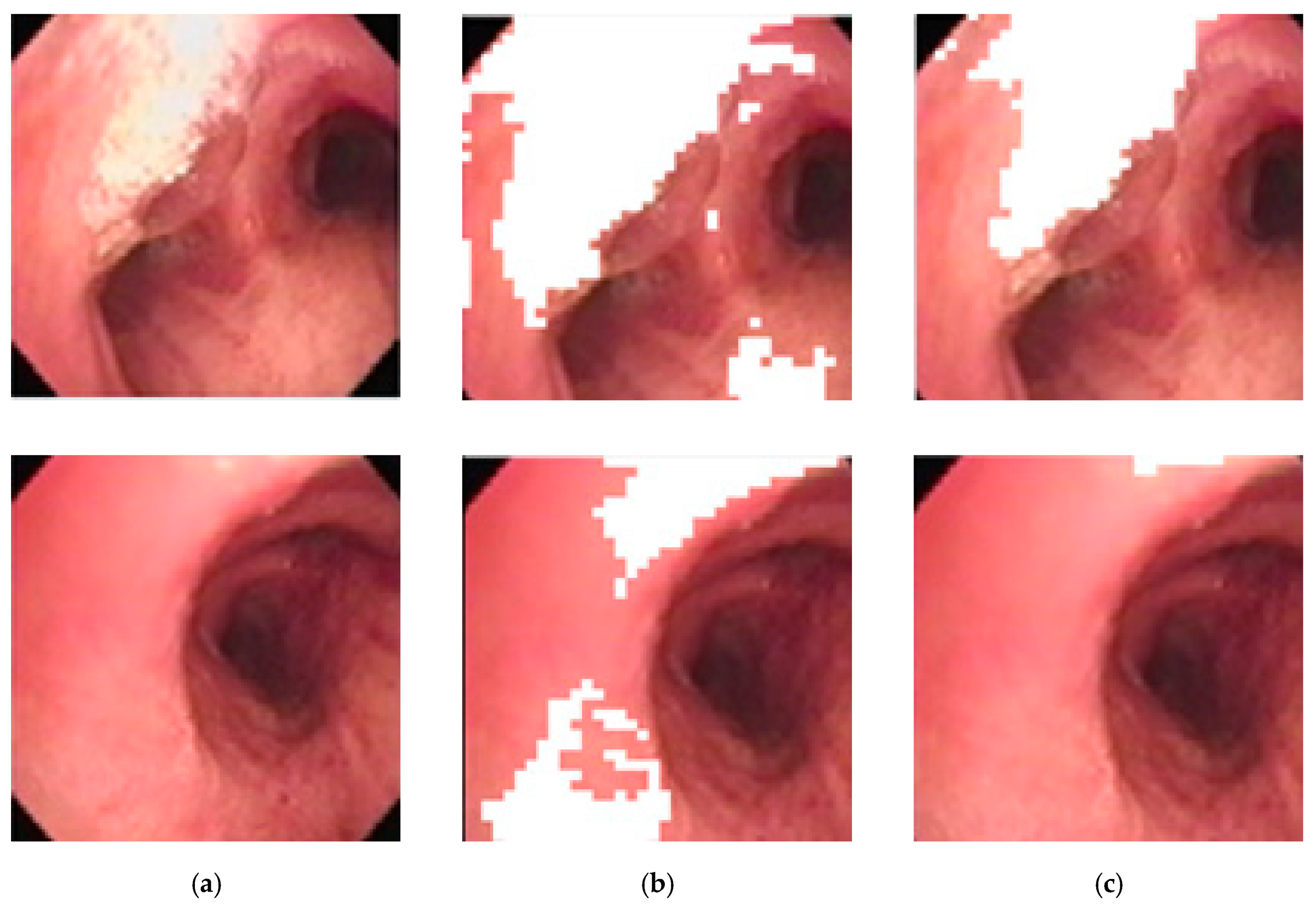 Sensors 20 06997 g010