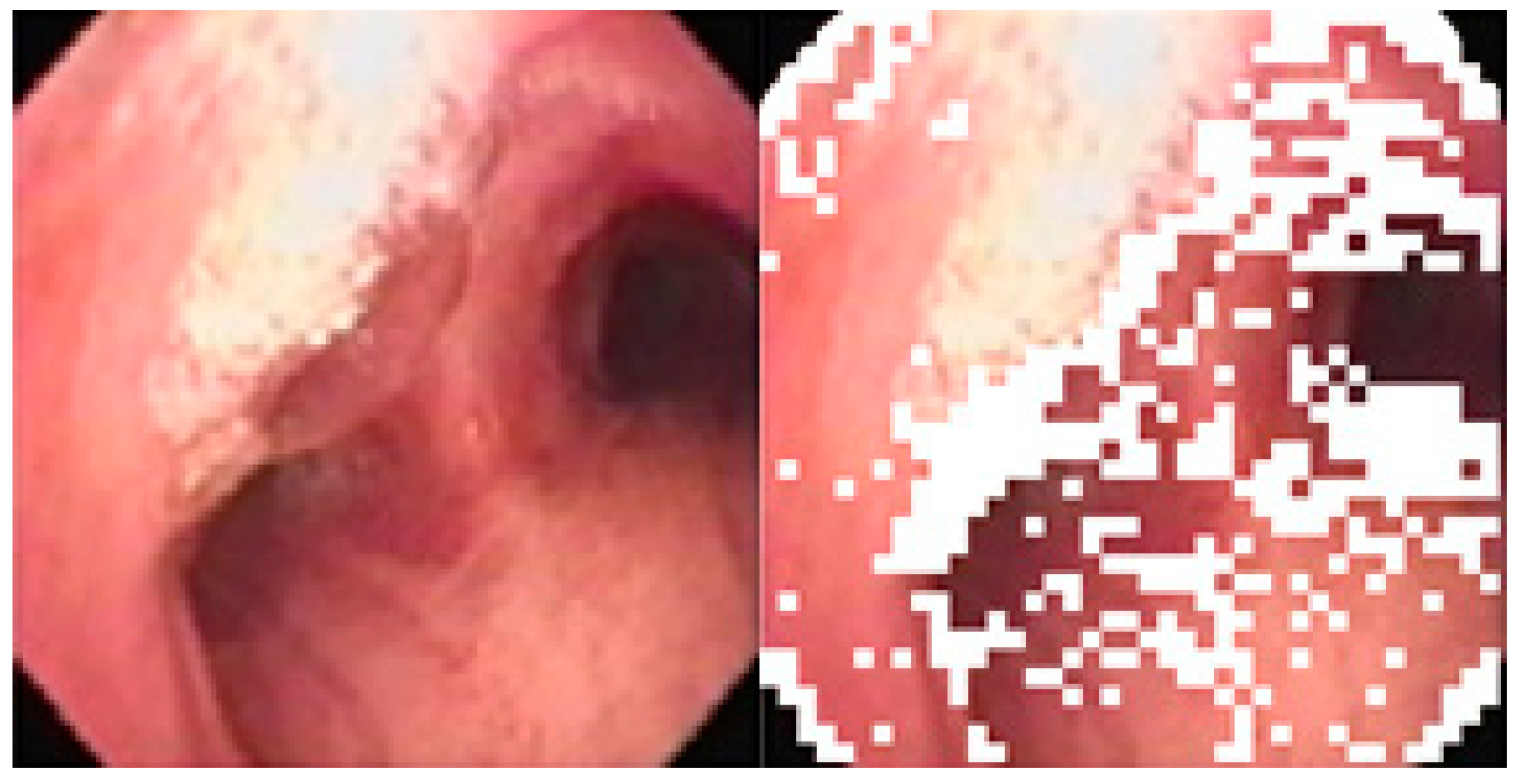 Sensors 20 06997 g011