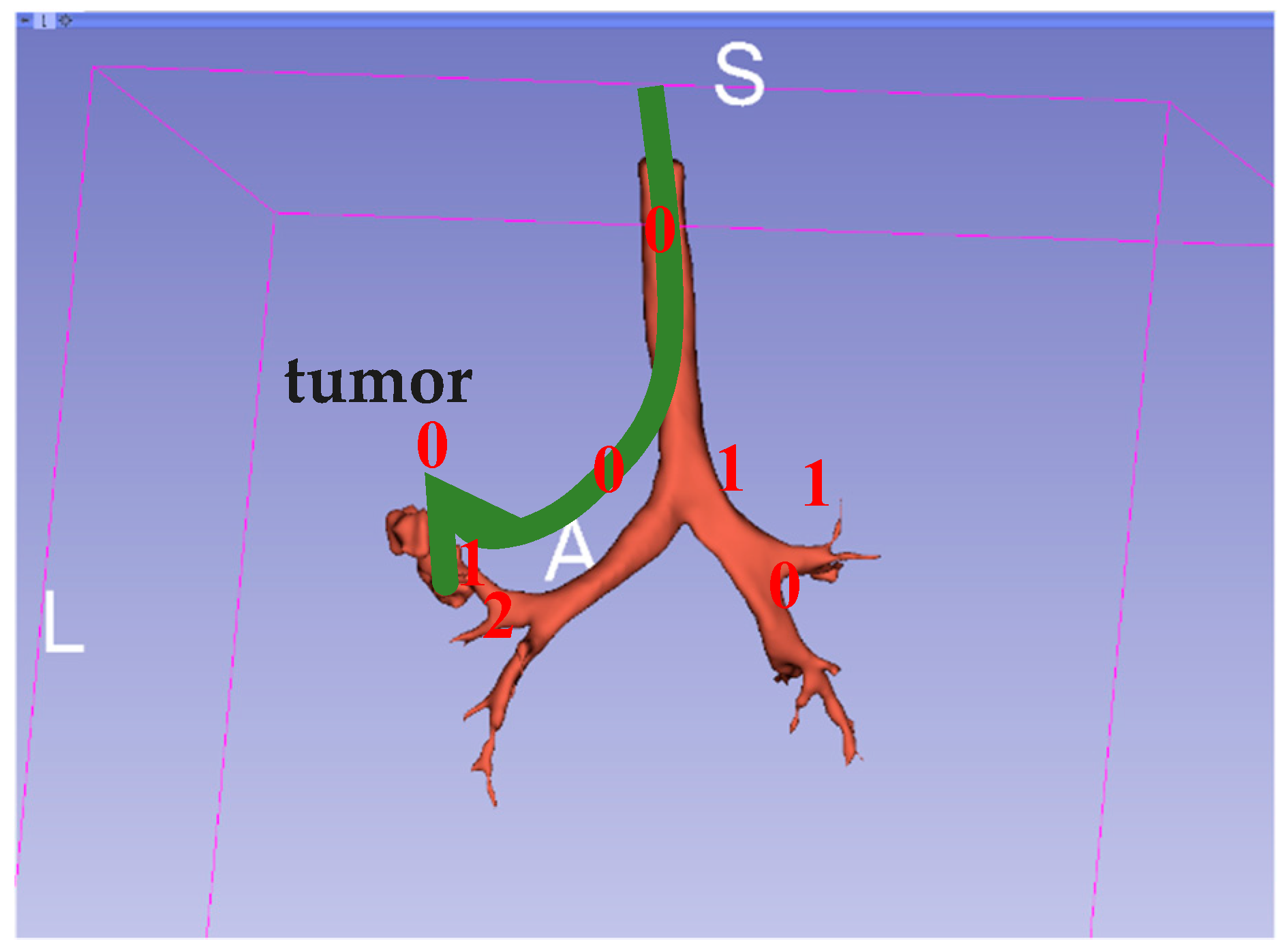 Sensors 20 06997 g014