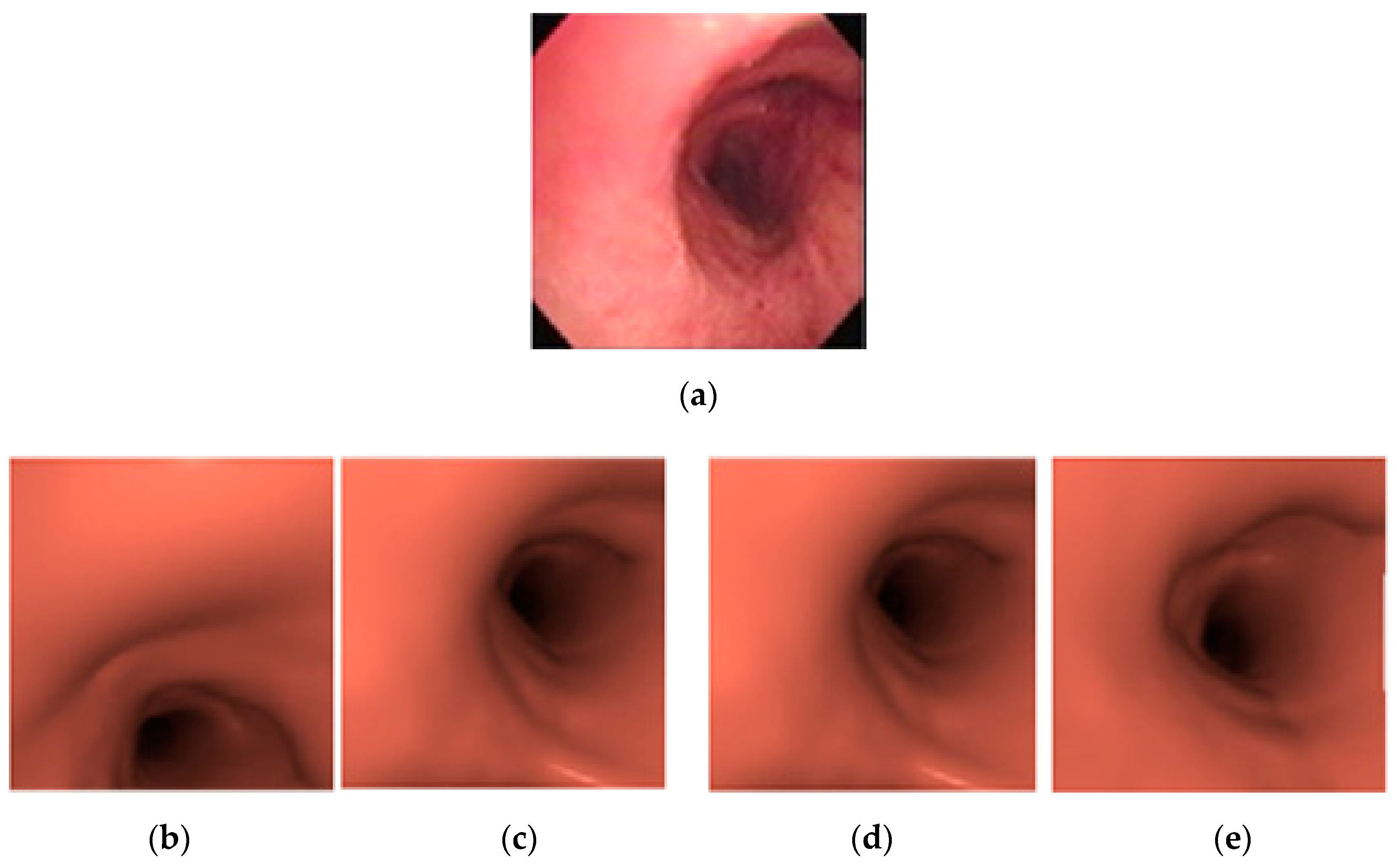 Sensors 20 06997 g016