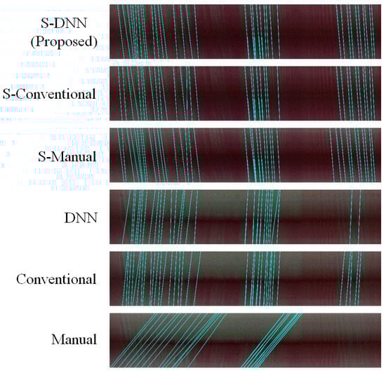 Sensors 20 07101 g0a1