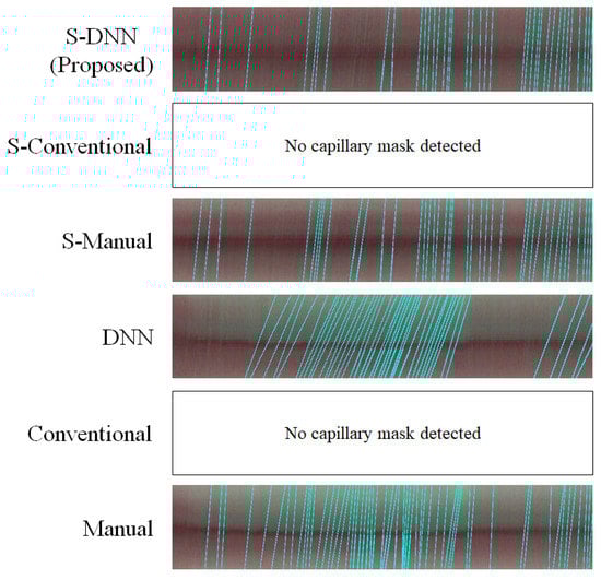 Sensors 20 07101 g0a2