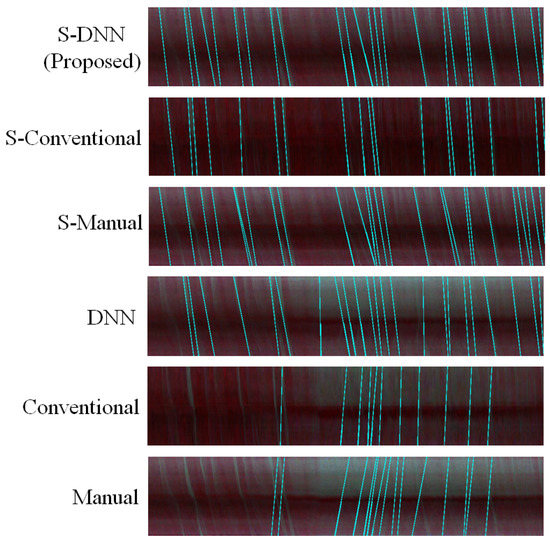 Sensors 20 07101 g0a3