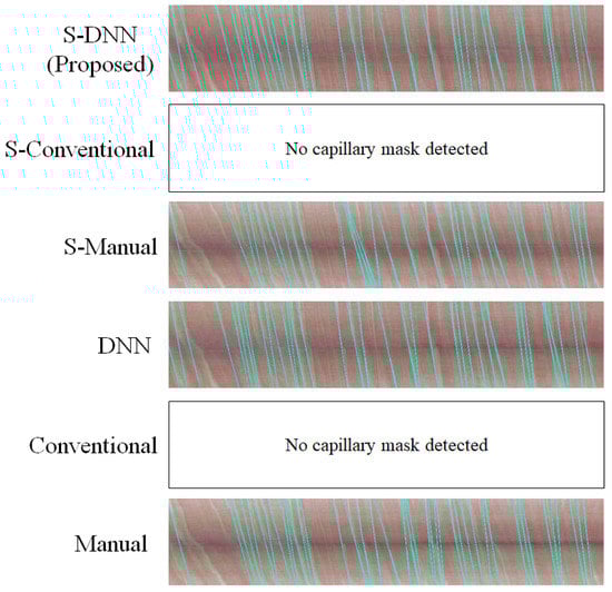 Sensors 20 07101 g0a5