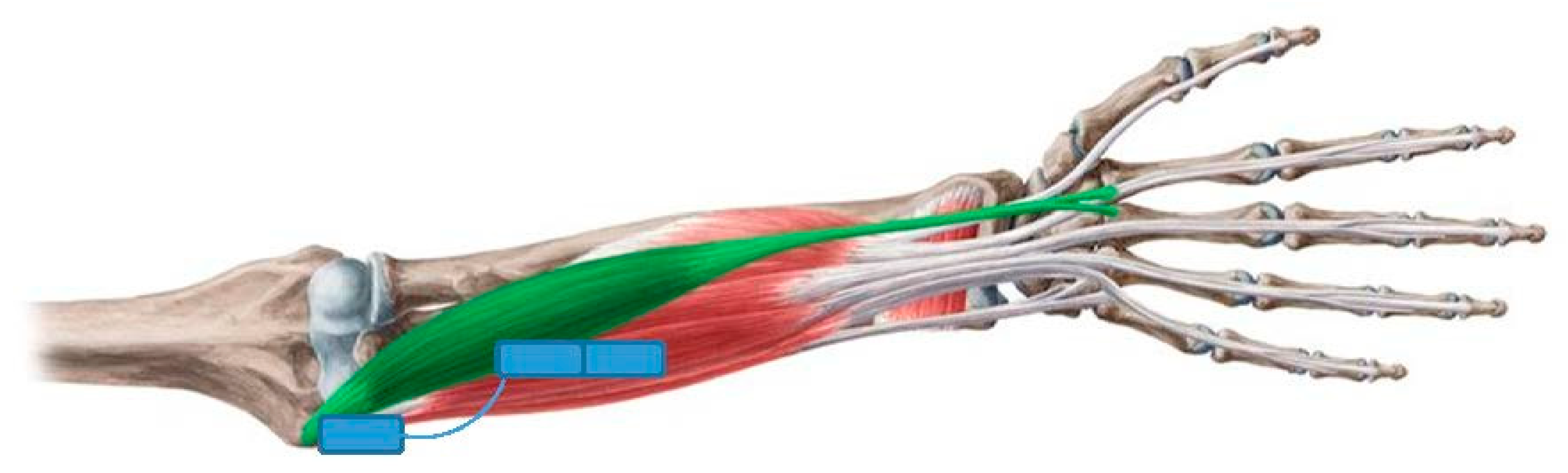 Sensors 21 00137 g006