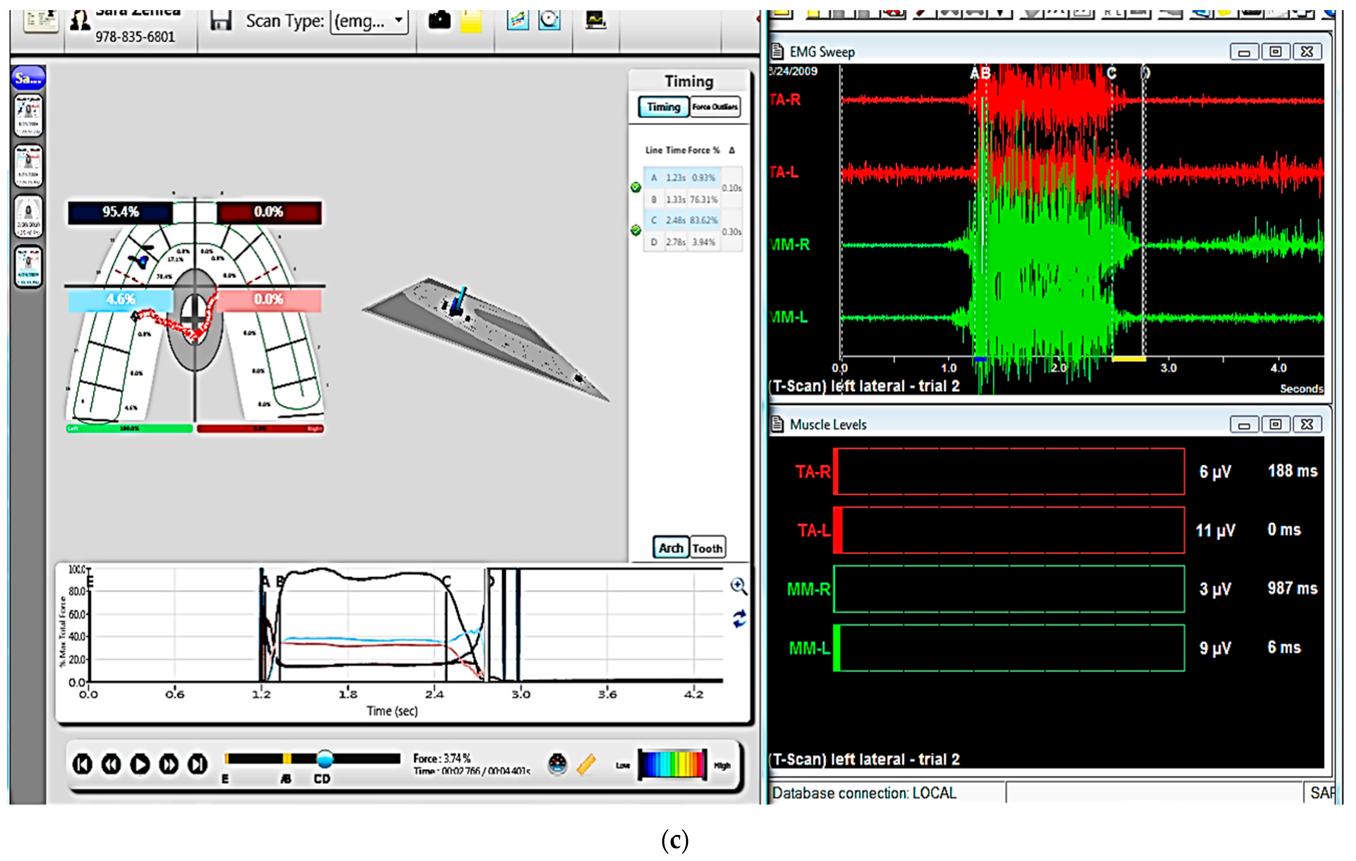 Sensors 21 00541 g003b